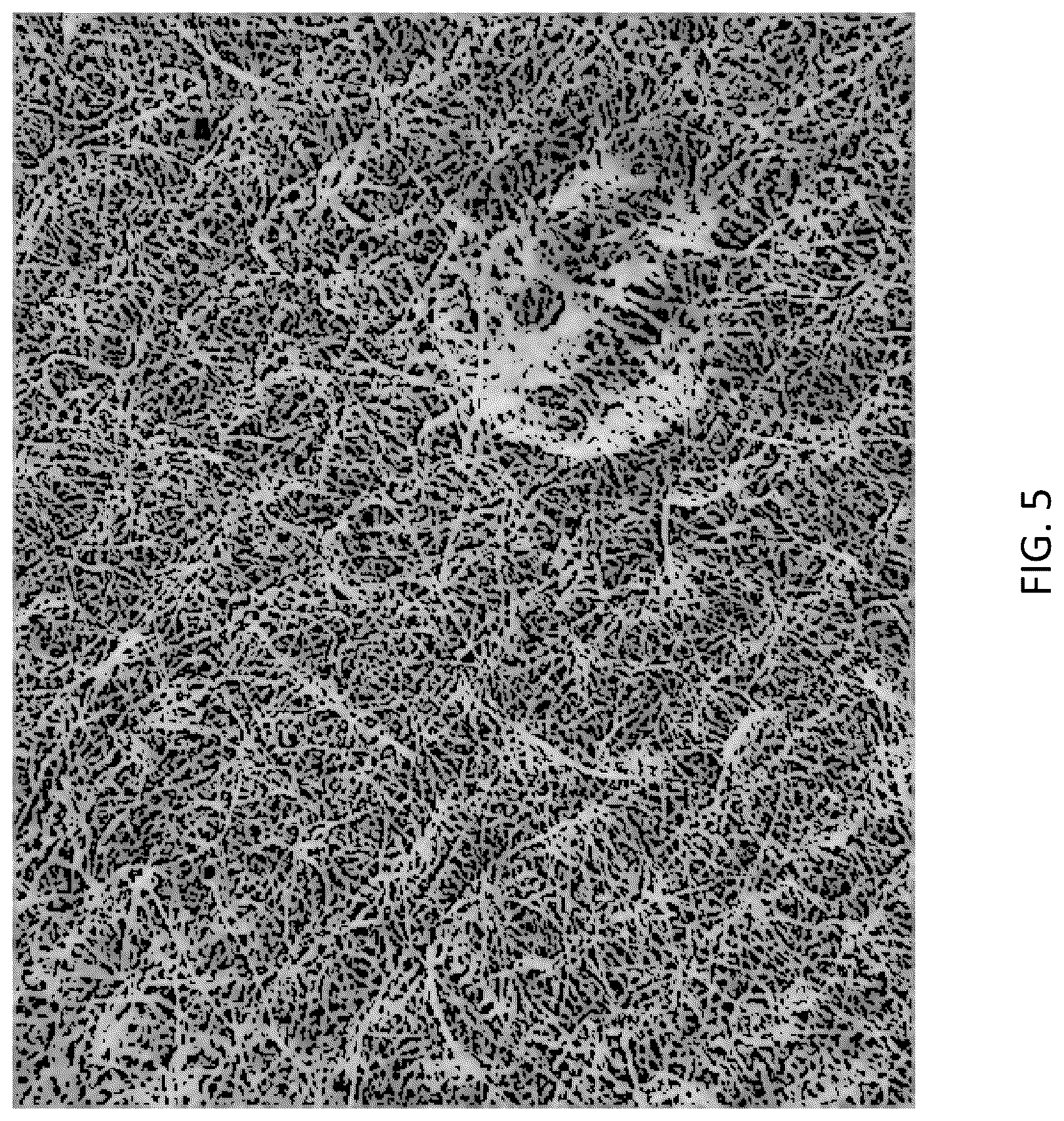 Patent US12338048 Figure 9 – Biodegradable pulp packaging products from natural fibers