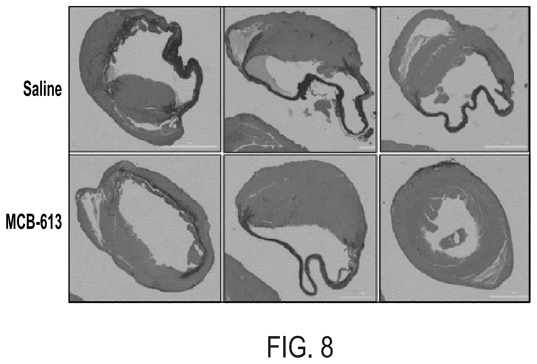 Patent US12338229 Figure 9 – Small molecule stimulators of steroid receptor coactivator-3 and methods of their use as cardioprotective and/or vascular regenerative agents