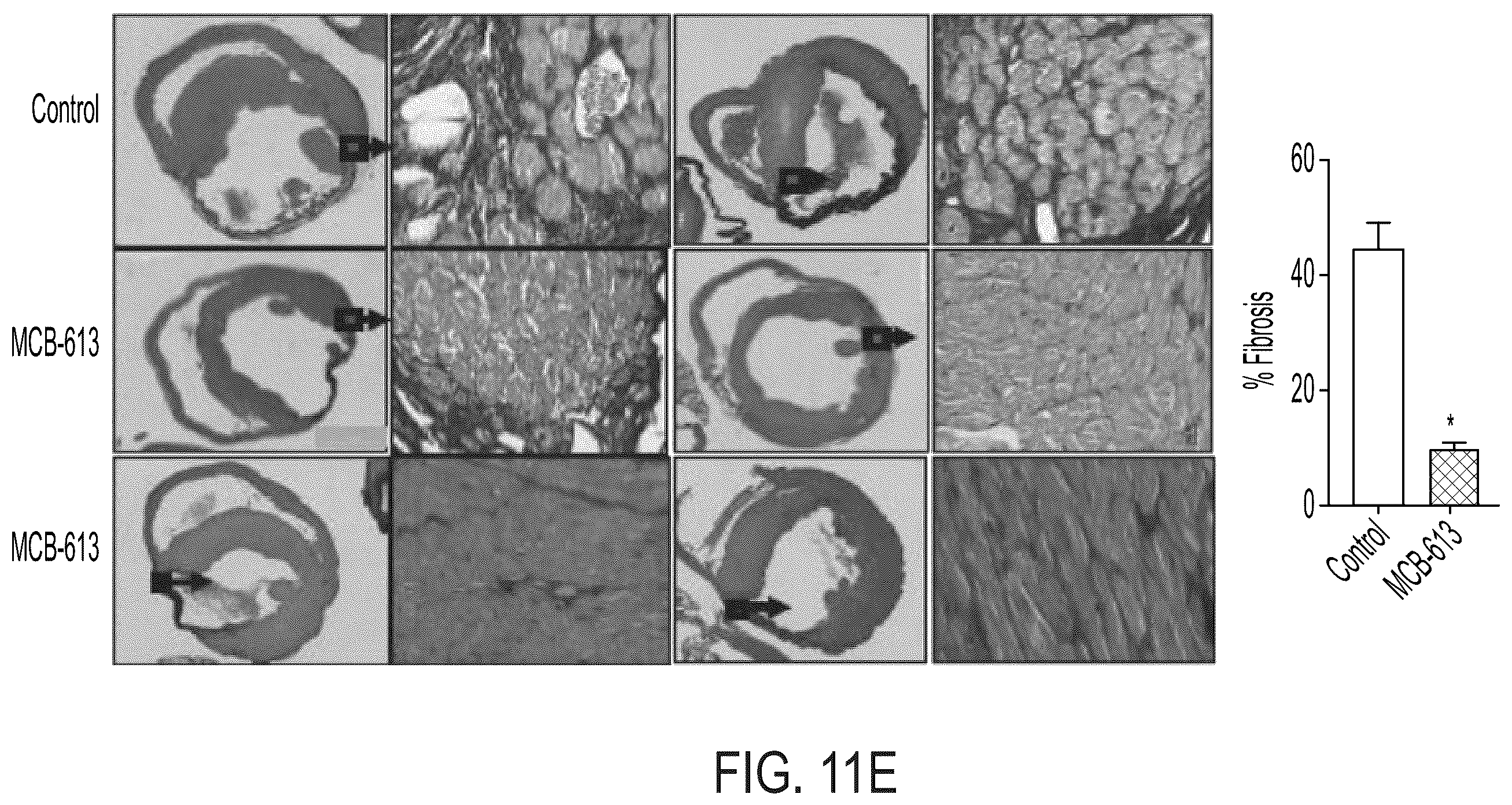 Patent US12338229 Figure 13 – Small molecule stimulators of steroid receptor coactivator-3 and methods of their use as cardioprotective and/or vascular regenerative agents