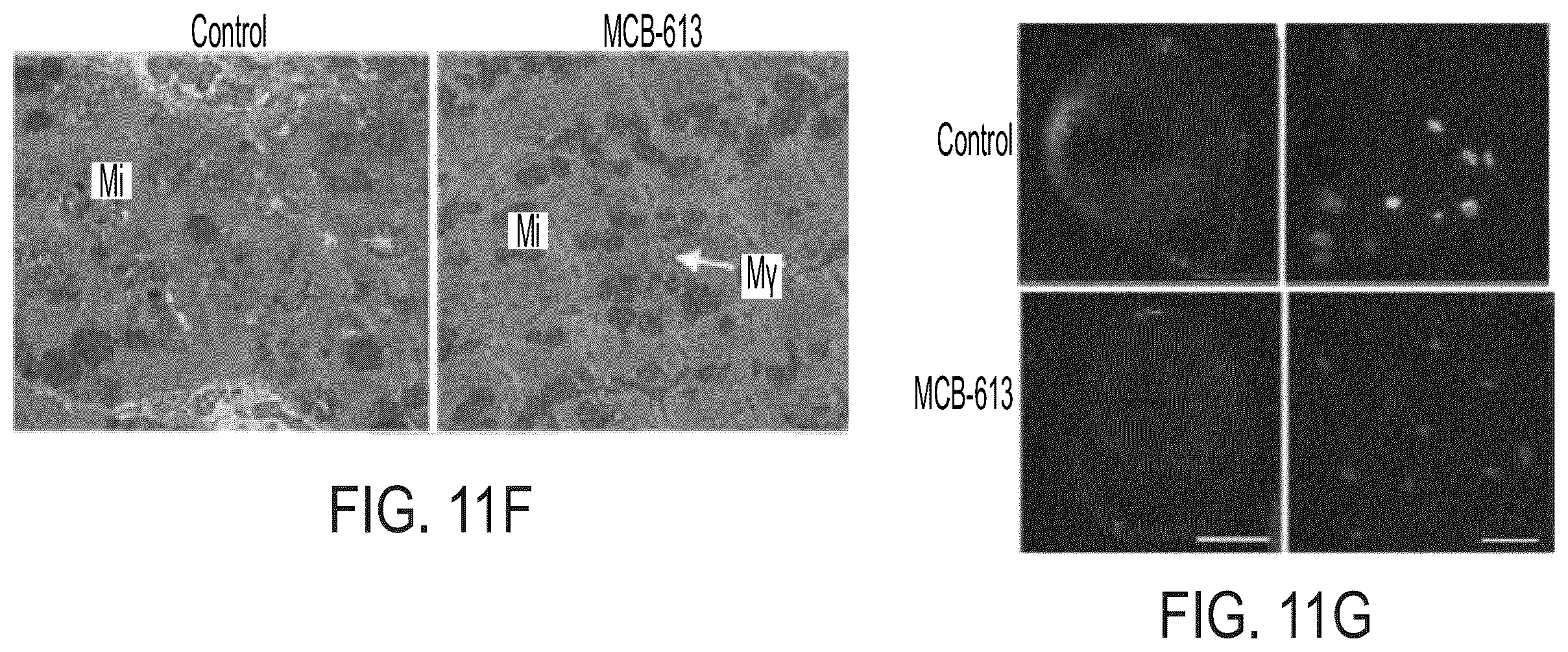 Patent US12338229 Figure 14 – Small molecule stimulators of steroid receptor coactivator-3 and methods of their use as cardioprotective and/or vascular regenerative agents