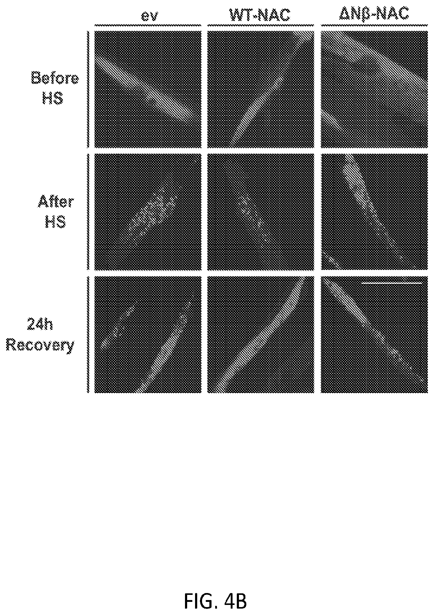 Patent US12338268 Figure 16 – Compositions and methods for treating protein aggregation-associated diseases