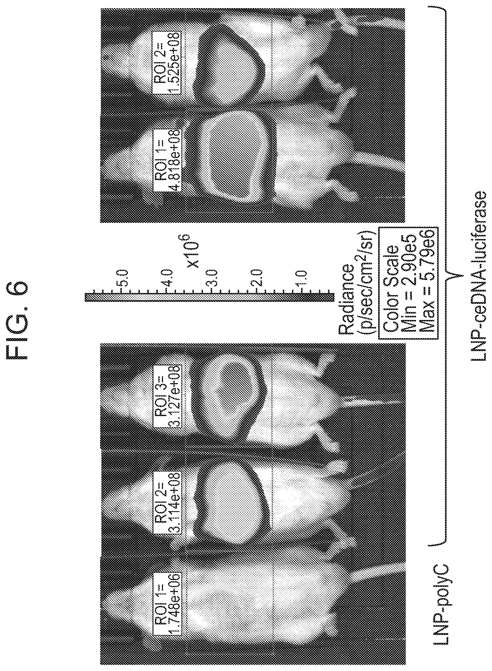 Patent US12338275 Figure 17 – Non-viral DNA vectors and uses thereof for expressing FVIII therapeutics