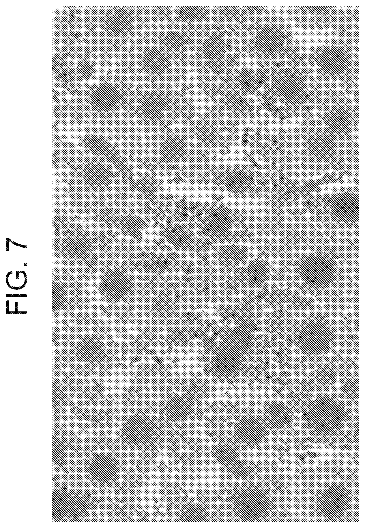 Patent US12338275 Figure 18 – Non-viral DNA vectors and uses thereof for expressing FVIII therapeutics