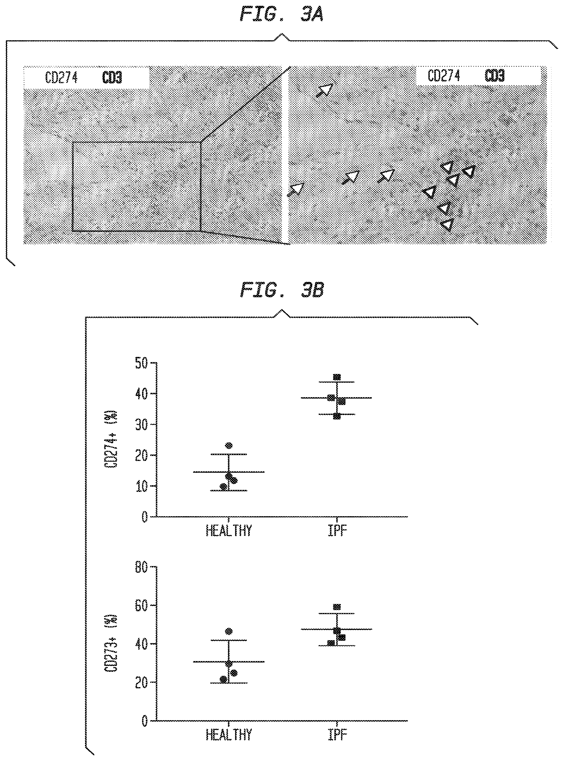 Patent US12338283 Figure 5 – Methods for targeting the immune checkpoint PD1 pathway for treating pulmonary fibrosis