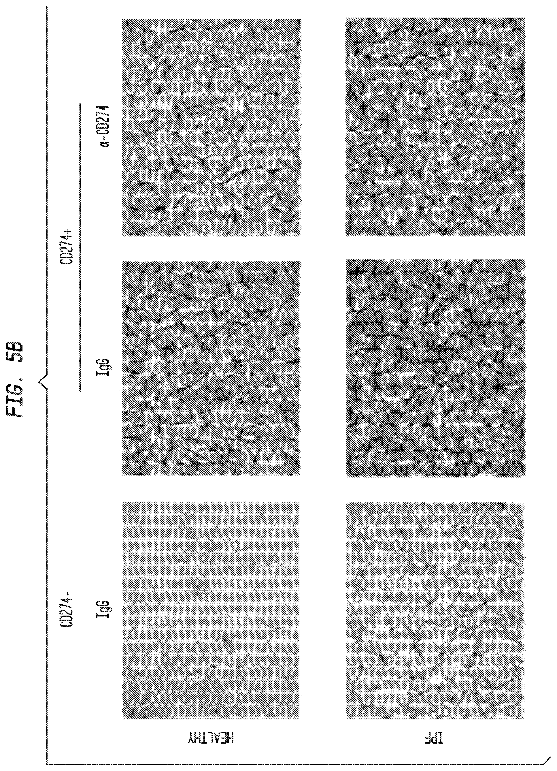Patent US12338283 Figure 8 – Methods for targeting the immune checkpoint PD1 pathway for treating pulmonary fibrosis