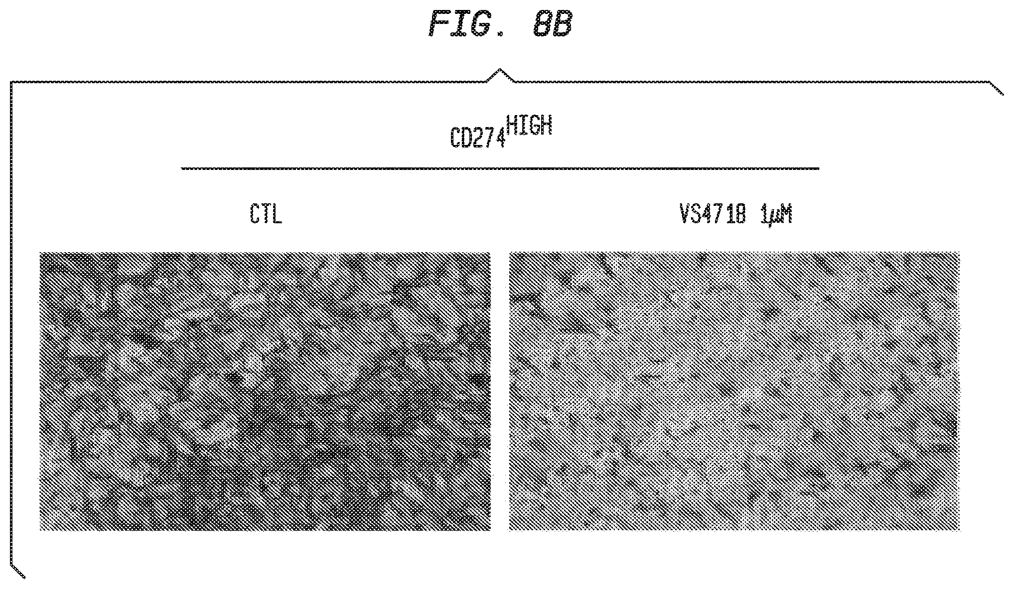 Patent US12338283 Figure 12 – Methods for targeting the immune checkpoint PD1 pathway for treating pulmonary fibrosis