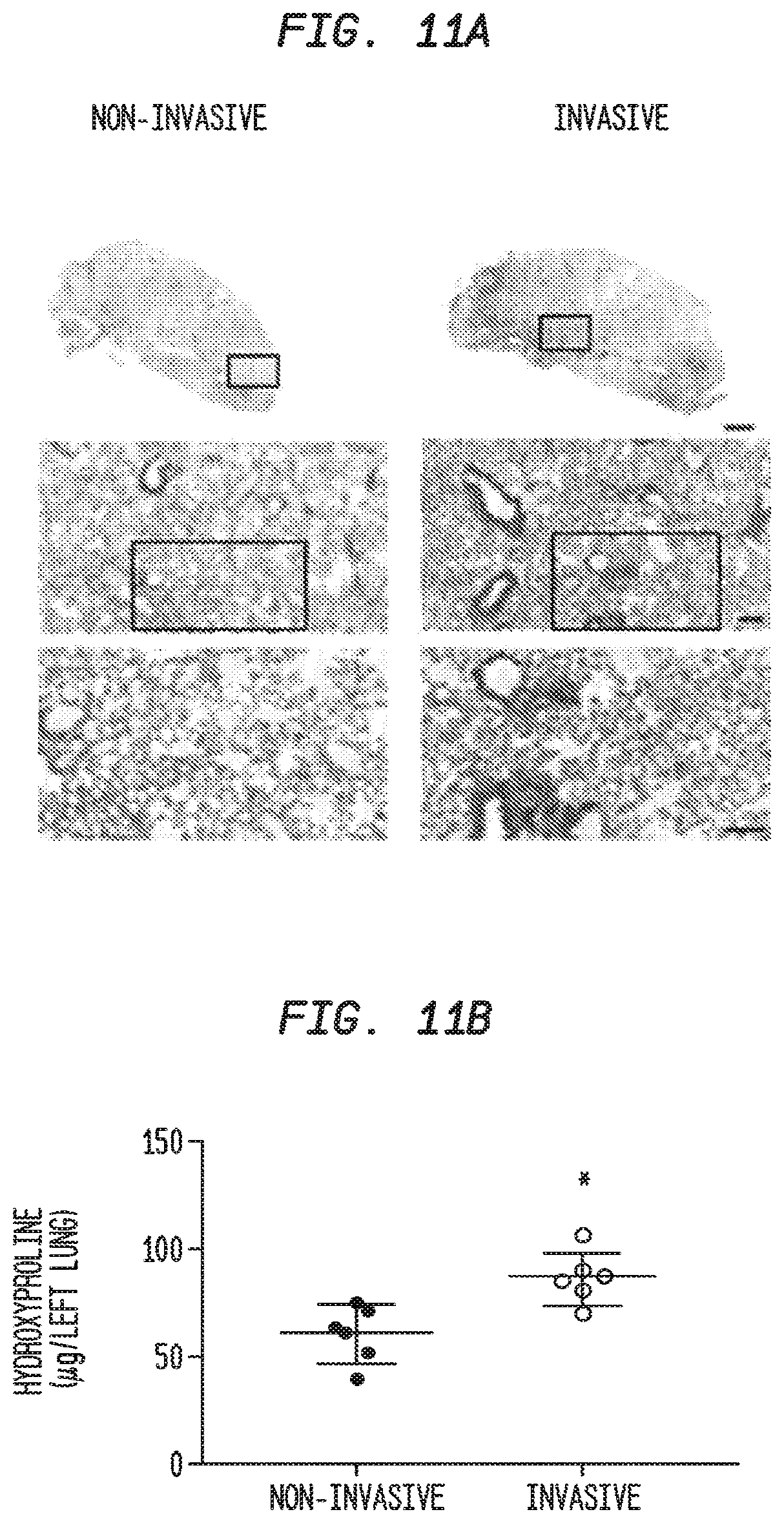 Patent US12338283 Figure 16 – Methods for targeting the immune checkpoint PD1 pathway for treating pulmonary fibrosis