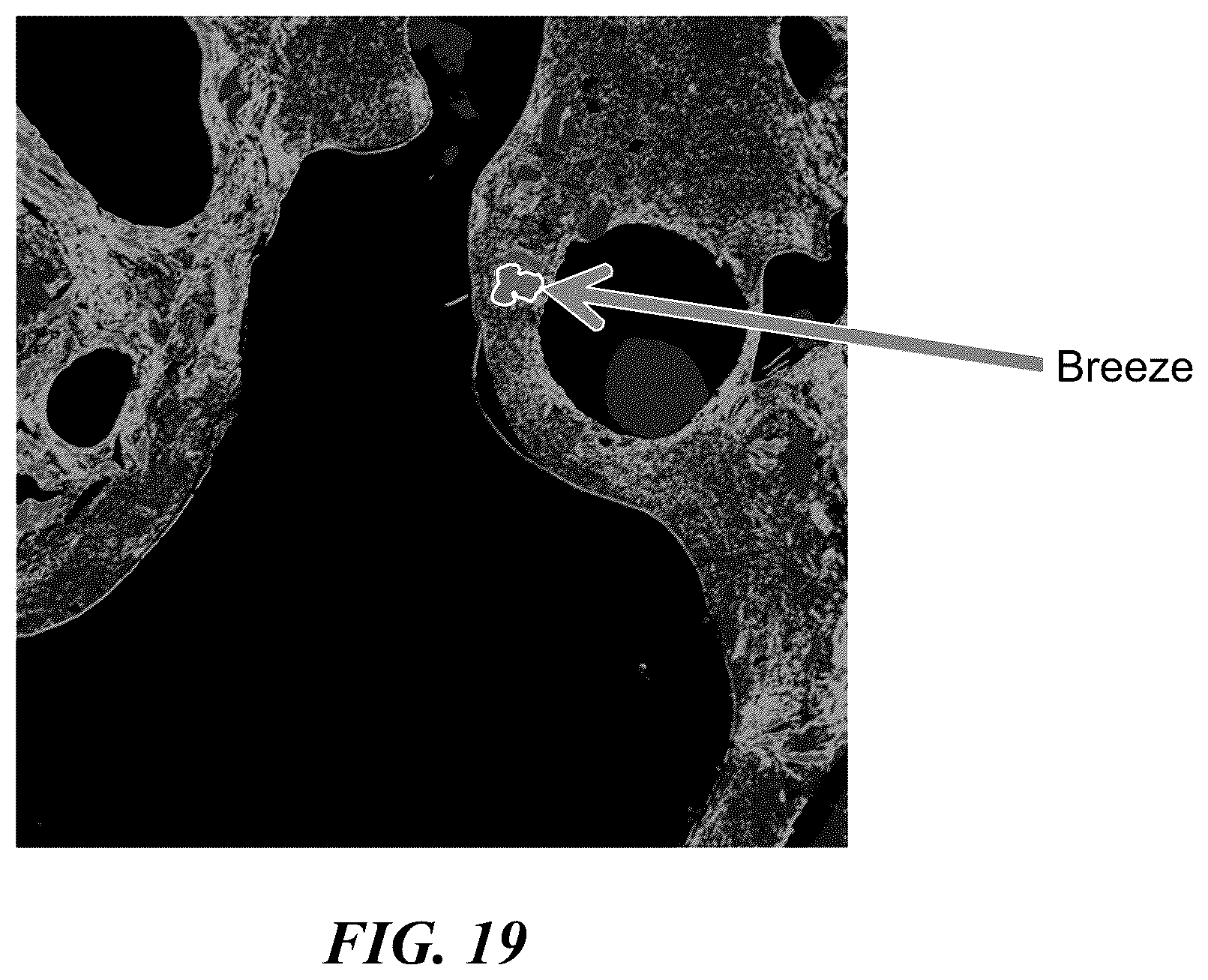 Patent US12338394 Figure 19 – Multi-modal beds of coking material