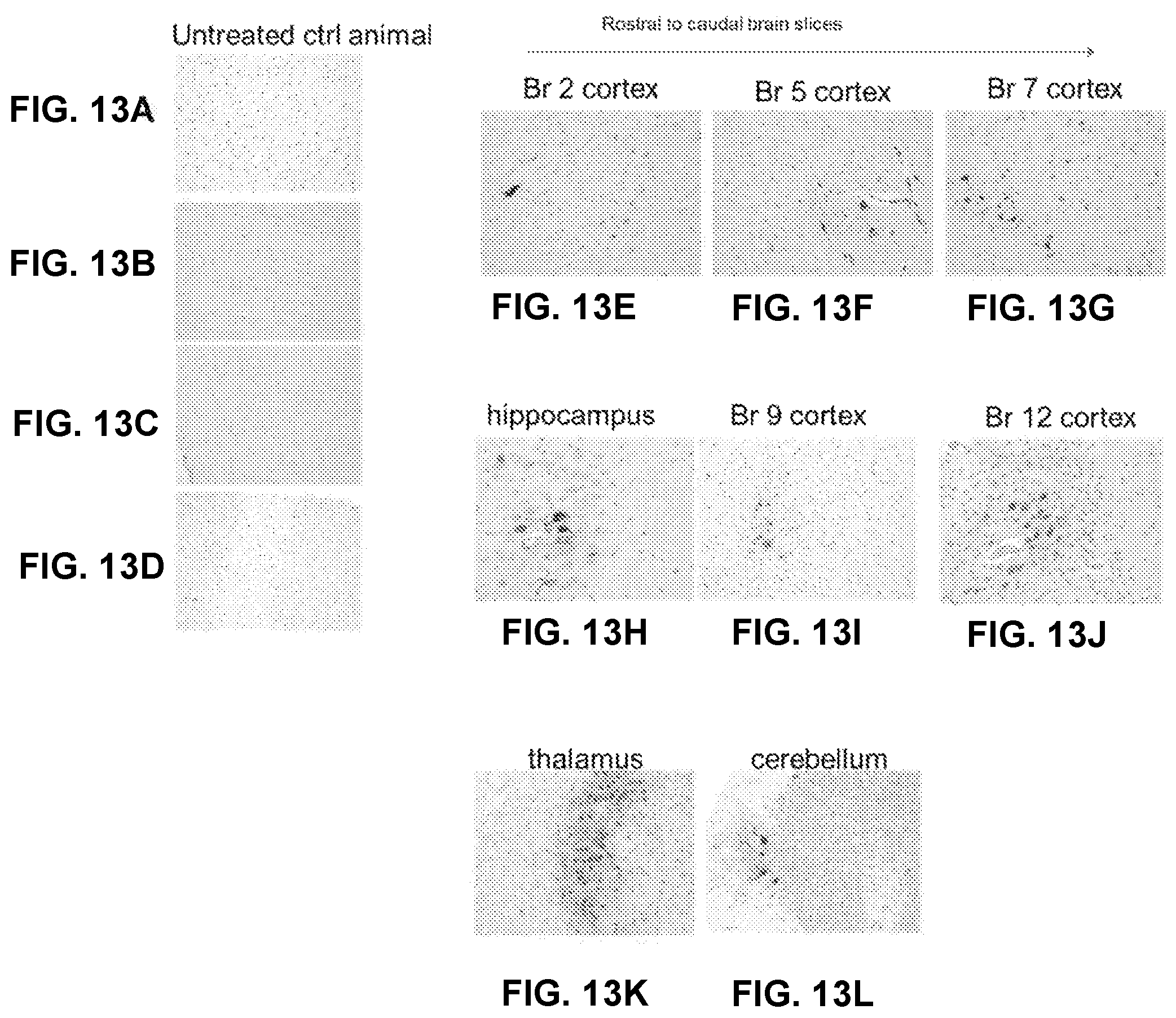 Patent US12338451 Figure 10 – Compositions useful in treatment of metachromatic leukodystrophy