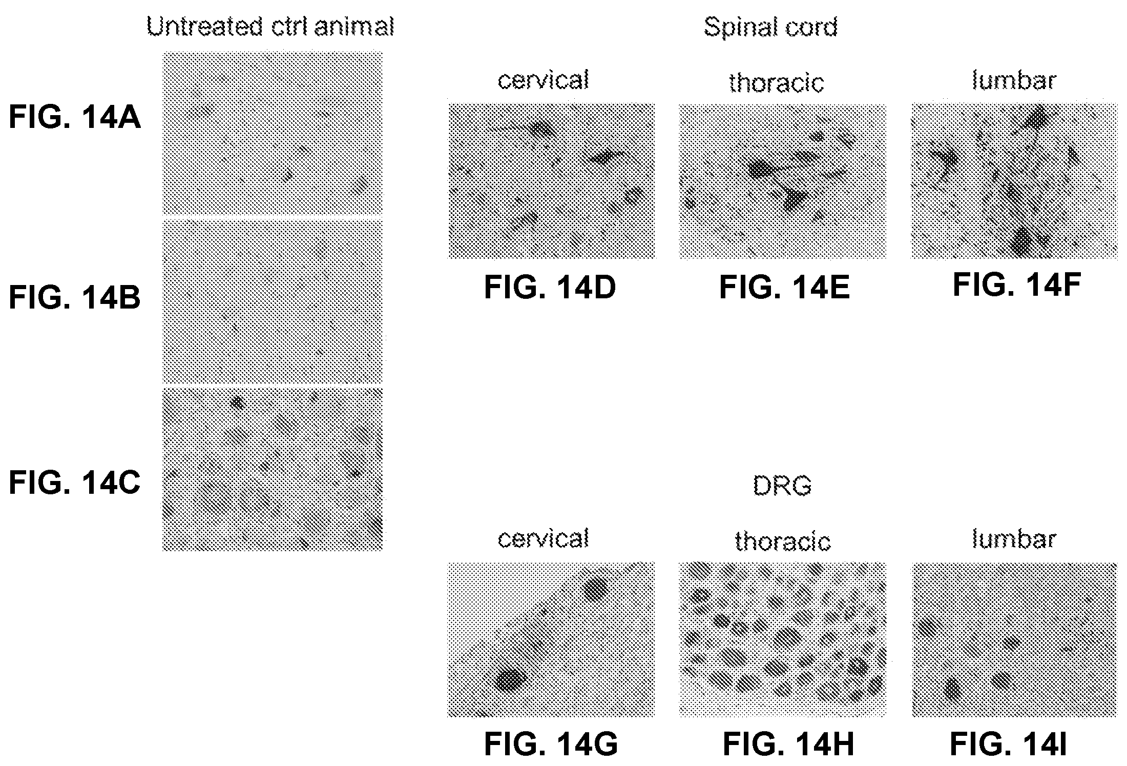 Patent US12338451 Figure 11 – Compositions useful in treatment of metachromatic leukodystrophy