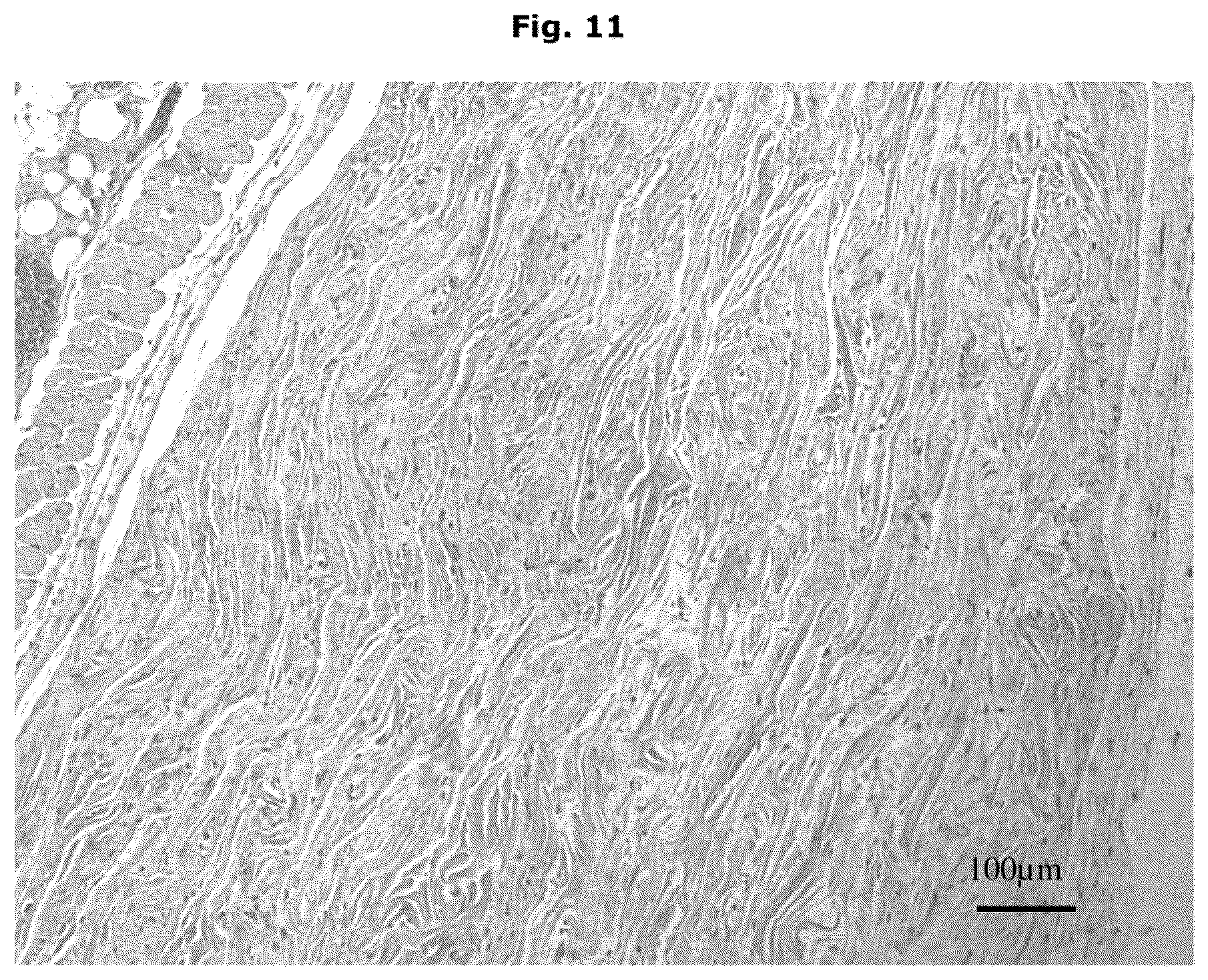 Patent US12338457 Figure 6 – Biologically functional soft tissue scaffolds and implants