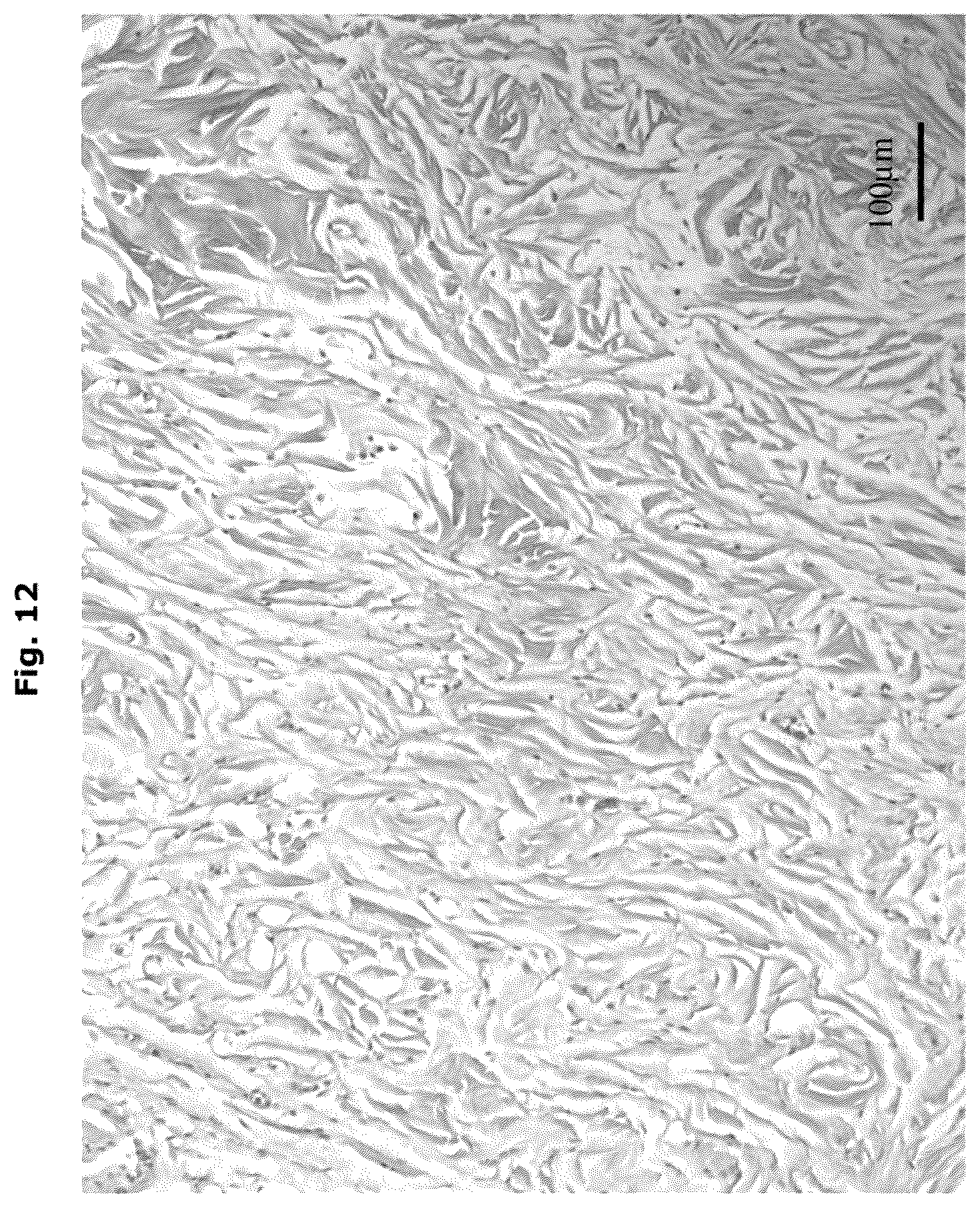 Patent US12338457 Figure 7 – Biologically functional soft tissue scaffolds and implants