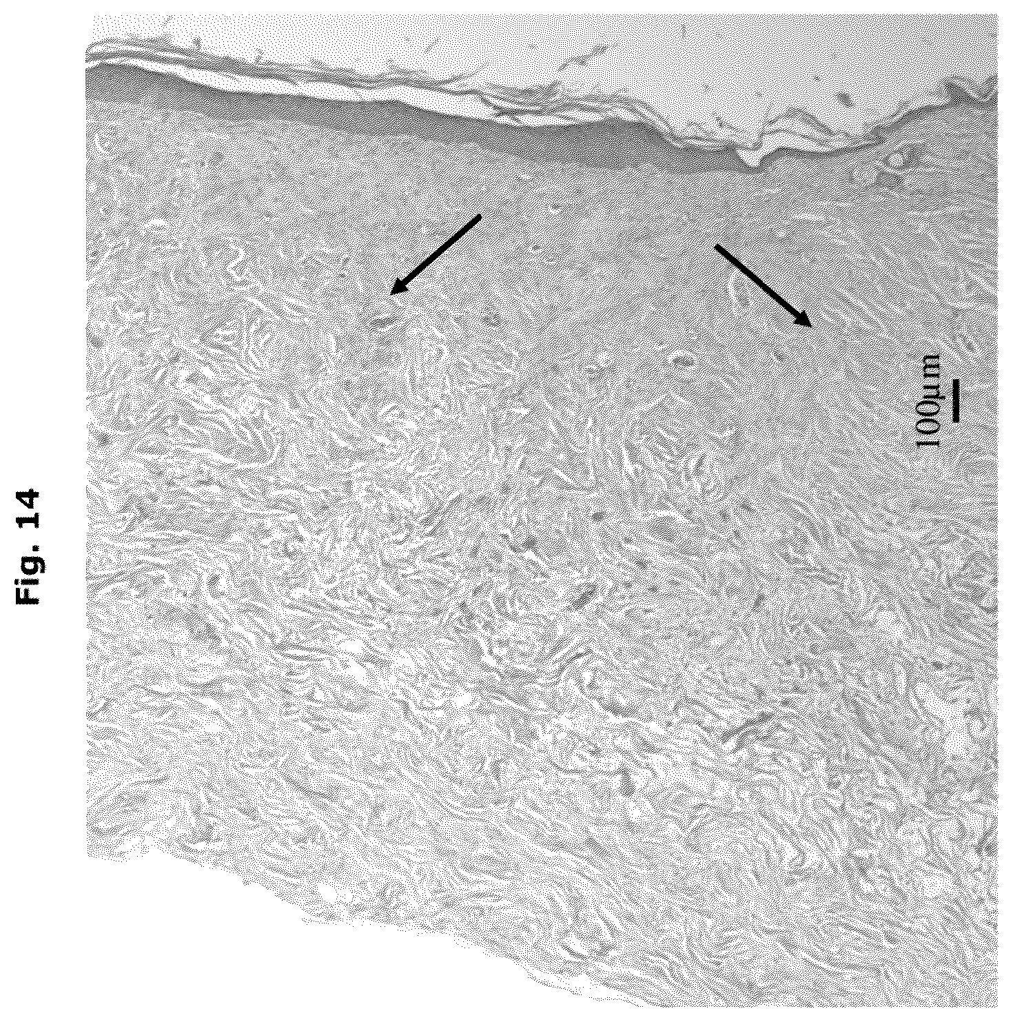 Patent US12338457 Figure 9 – Biologically functional soft tissue scaffolds and implants