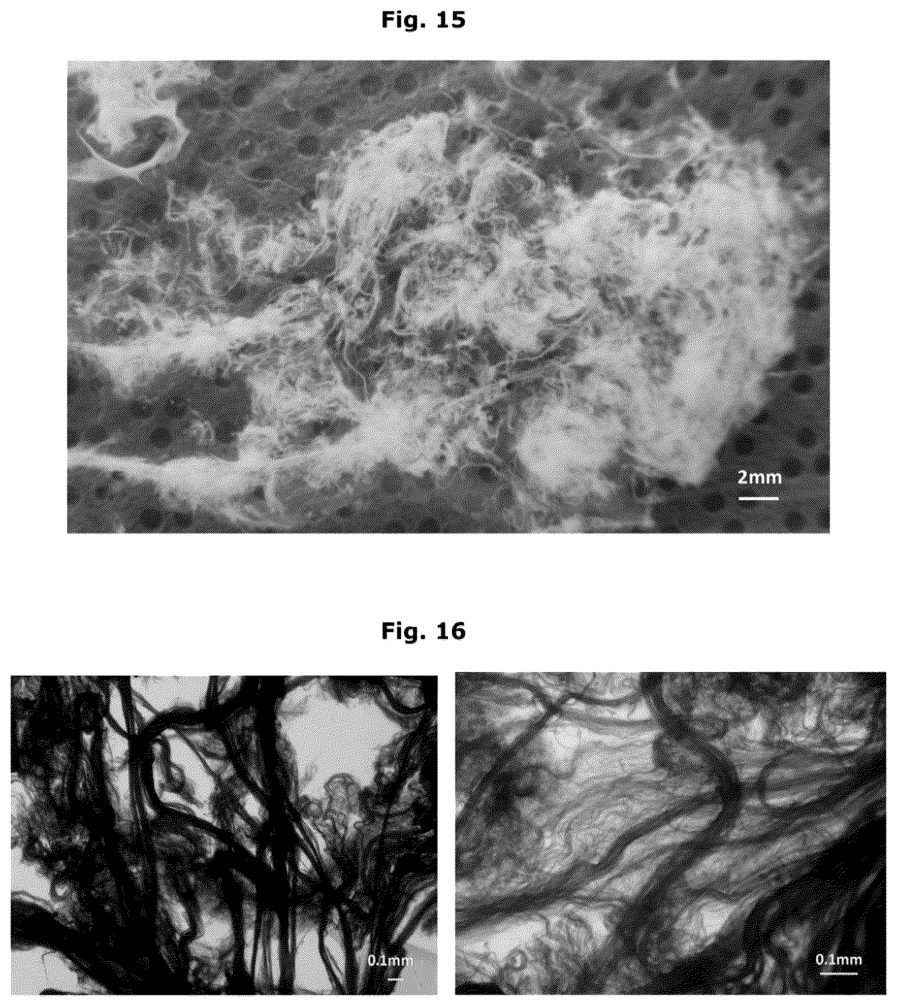 Patent US12338457 Figure 10 – Biologically functional soft tissue scaffolds and implants