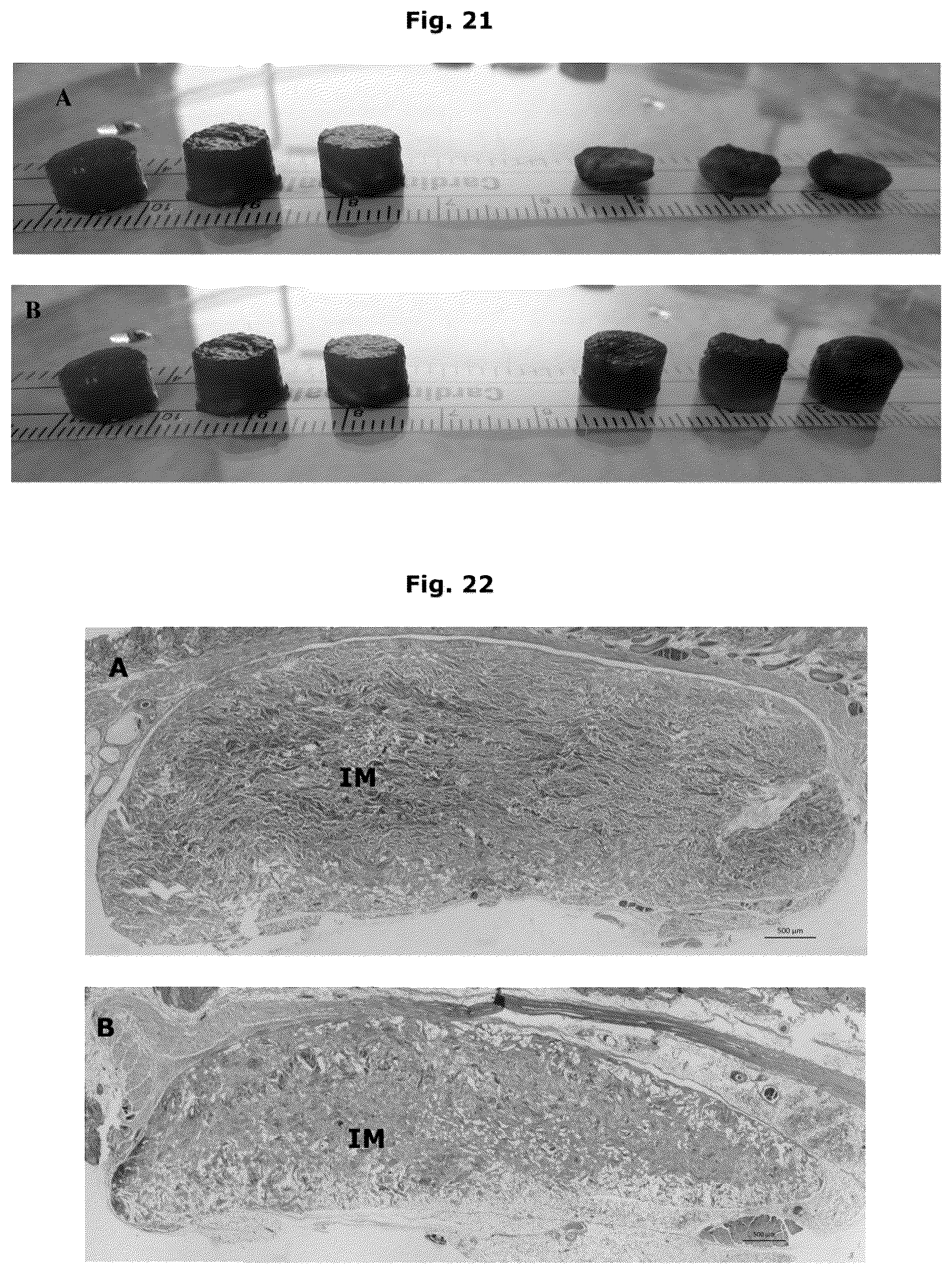 Patent US12338457 Figure 13 – Biologically functional soft tissue scaffolds and implants