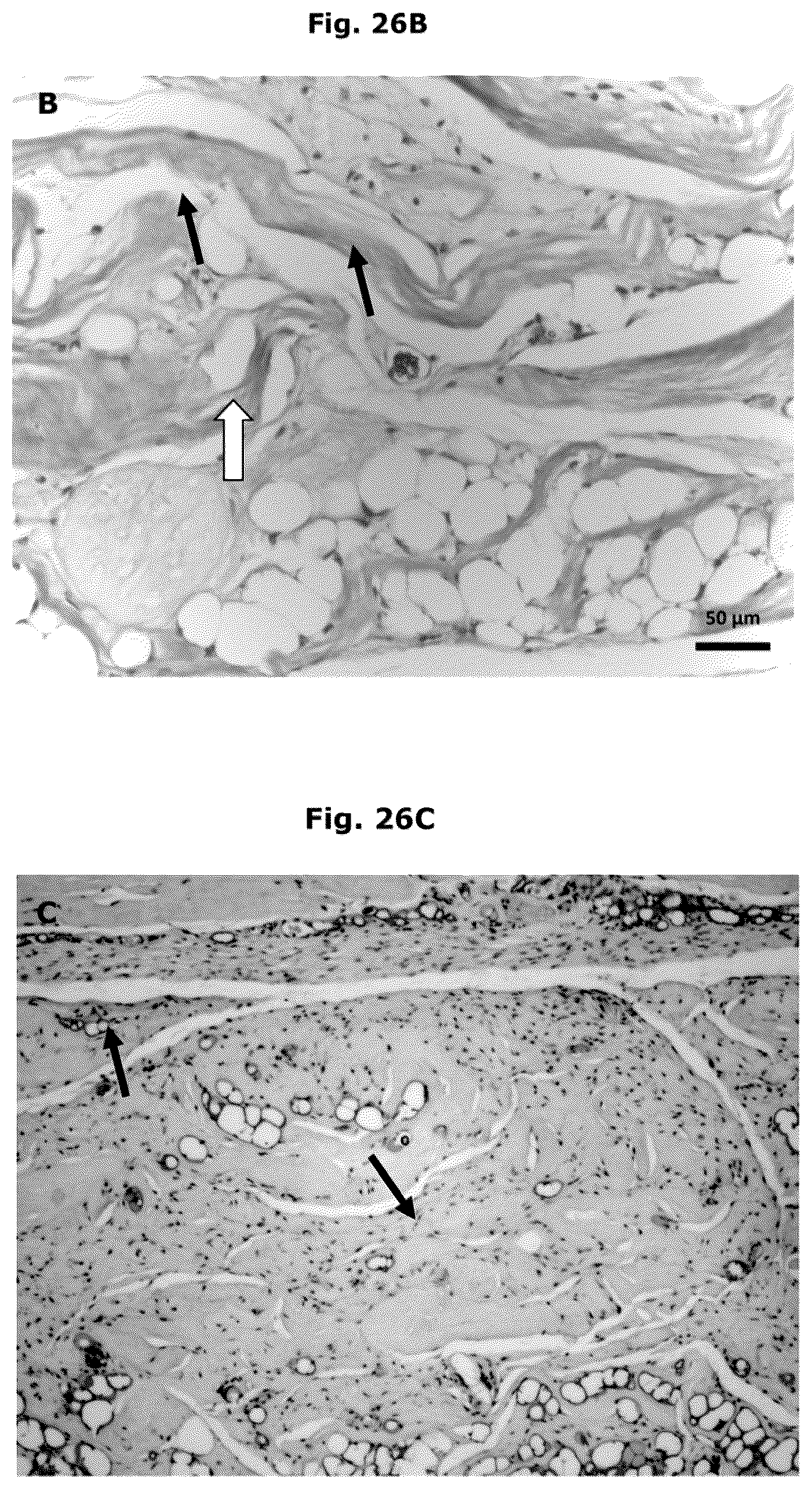 Patent US12338457 Figure 16 – Biologically functional soft tissue scaffolds and implants