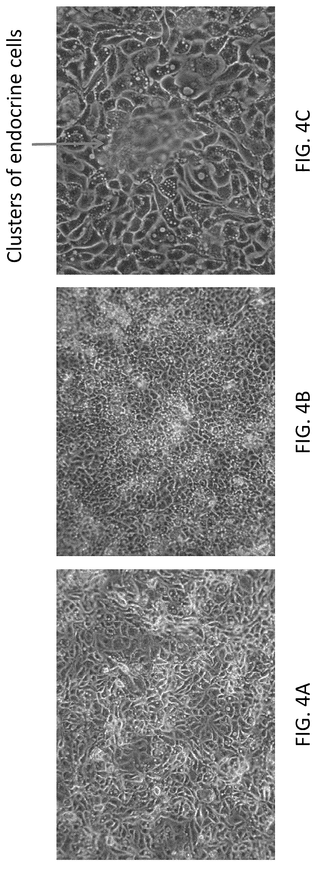 Patent US12338462 Figure 5 – Induction of pancreatic beta cells by stem cell differentiation with RNA