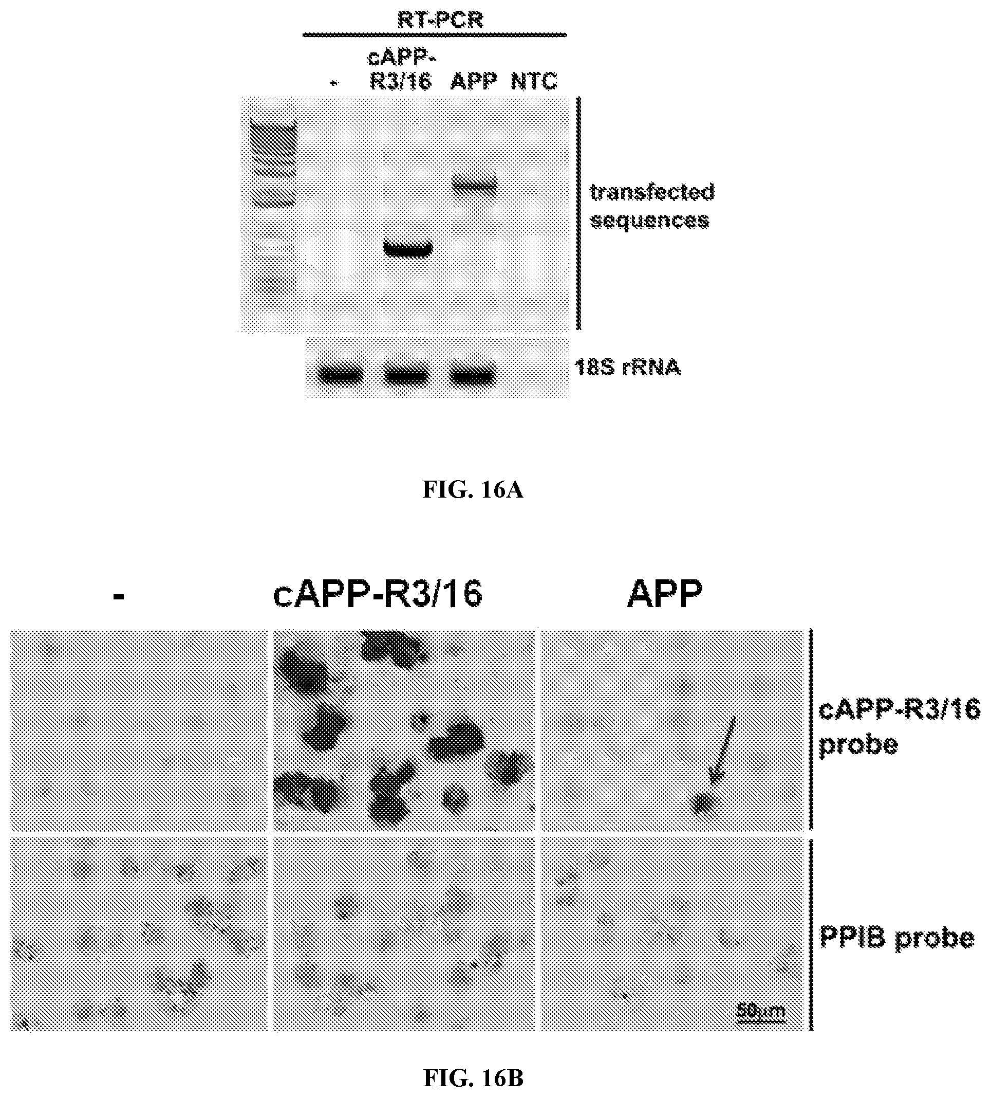 Patent US12338495 Figure 13 – Methods of diagnosing and treating Alzheimer's disease