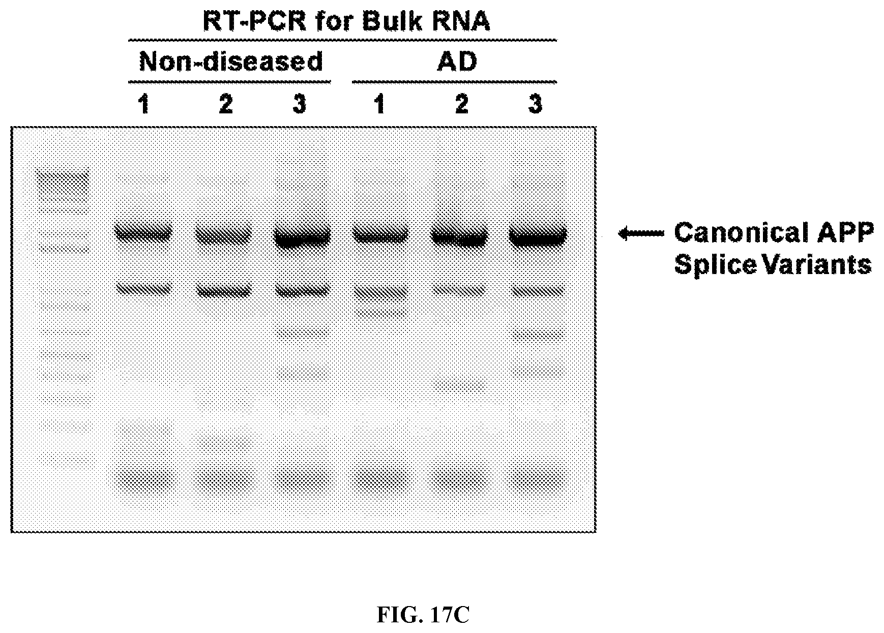 Patent US12338495 Figure 15 – Methods of diagnosing and treating Alzheimer's disease
