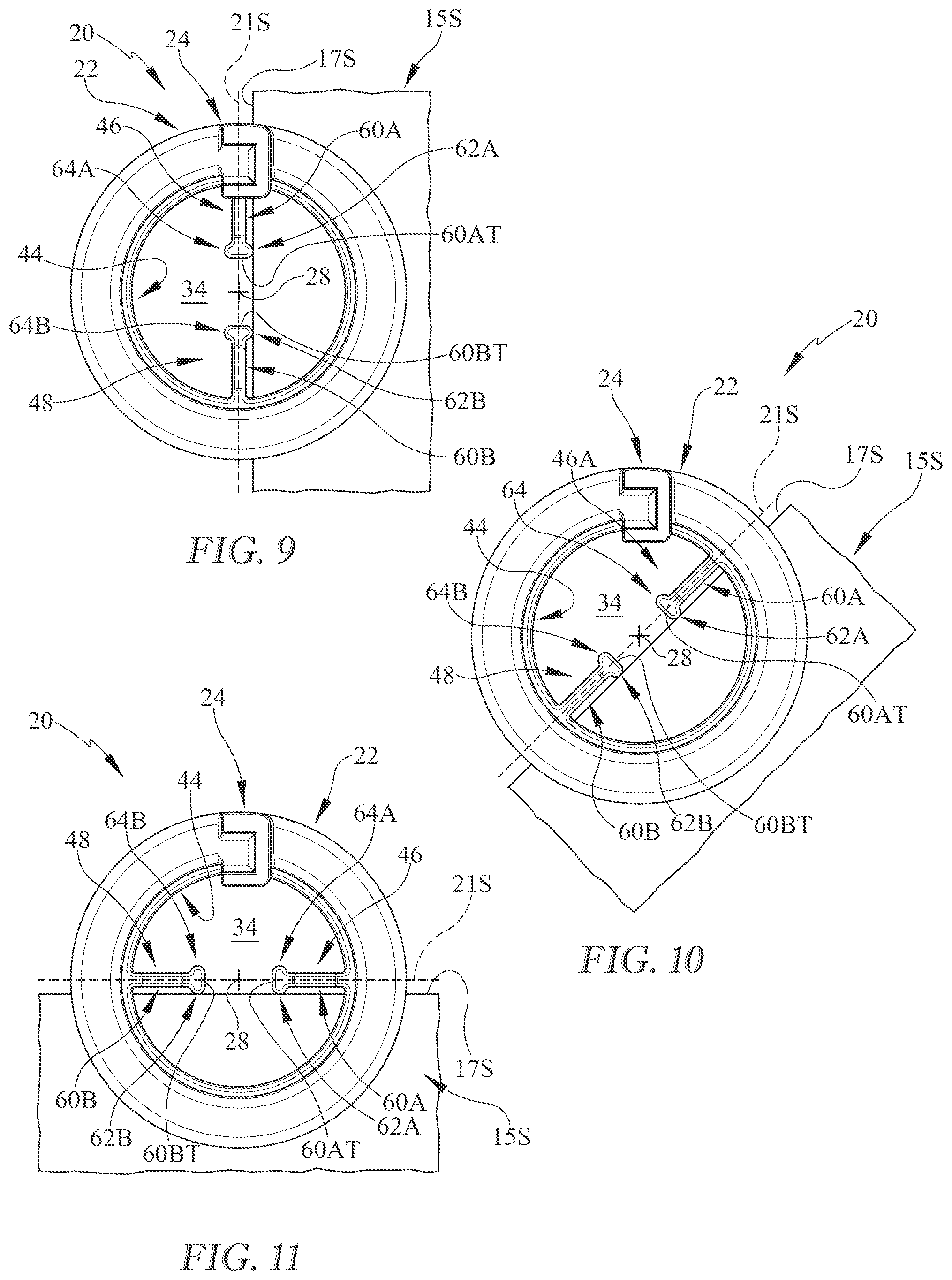 Patent US12338563 Figure 7 – Close stitch hopping foot