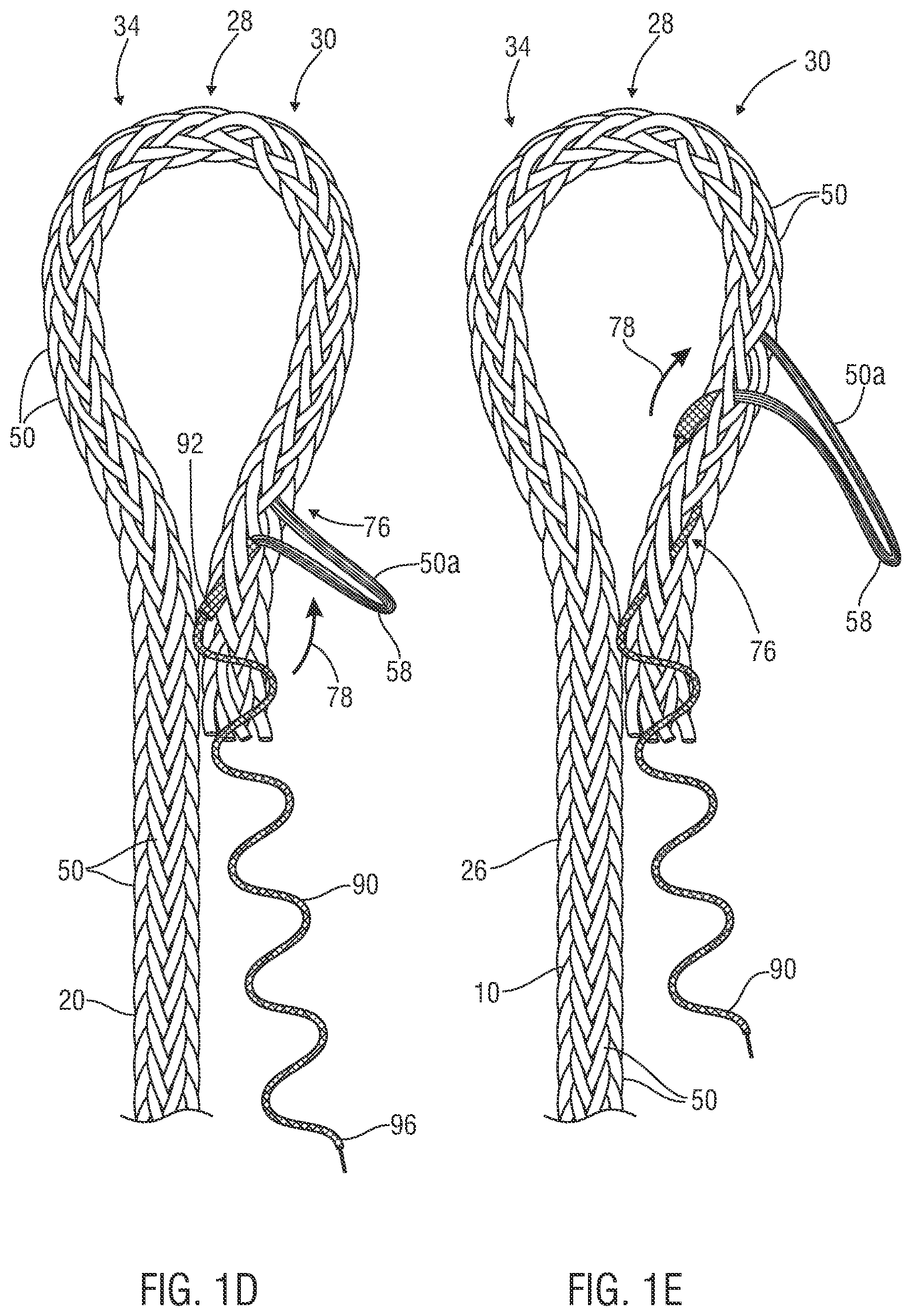Patent US12338577 Figure 3 – Rope eye splice and systems, apparatus and methods for forming an eye in a rope