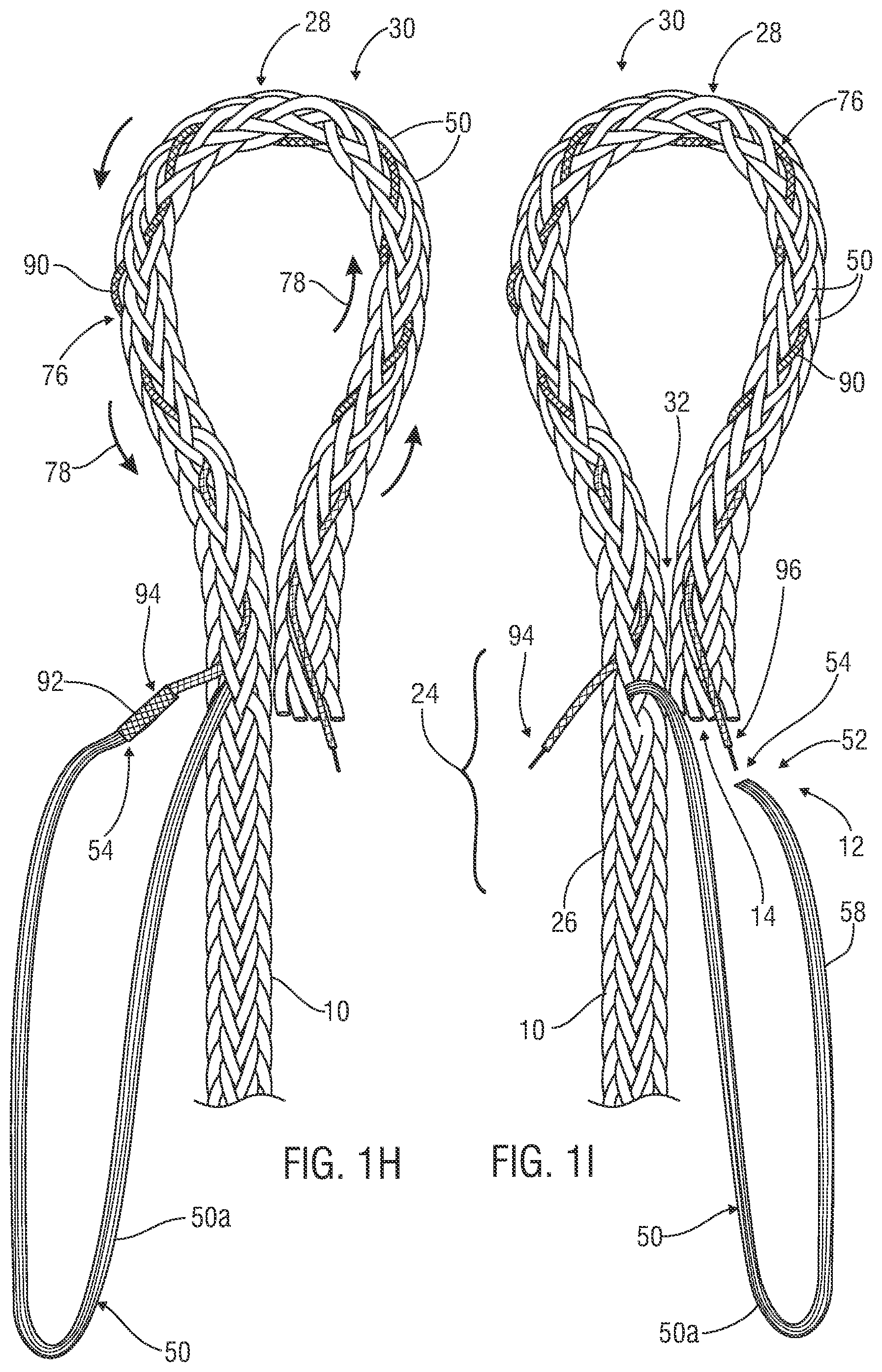 Patent US12338577 Figure 5 – Rope eye splice and systems, apparatus and methods for forming an eye in a rope