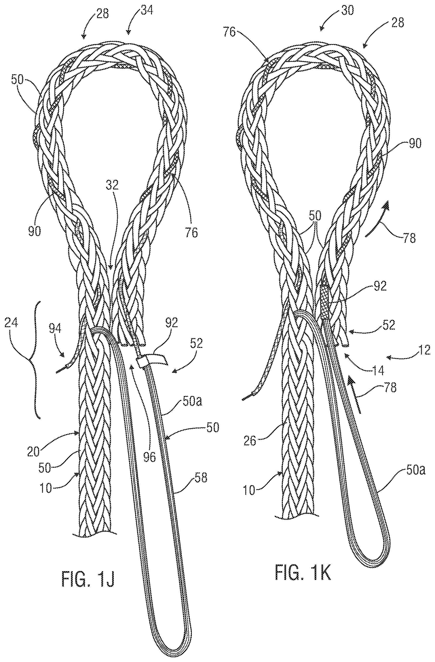 Patent US12338577 Figure 6 – Rope eye splice and systems, apparatus and methods for forming an eye in a rope