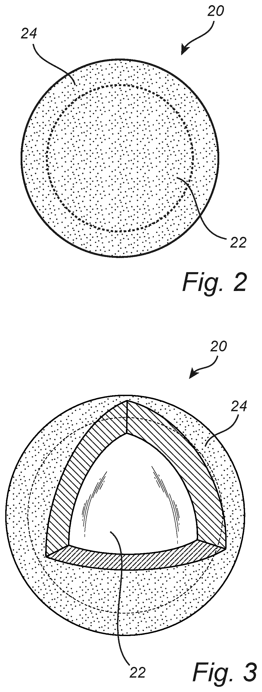 Patent US12338581 Figure 2 – Noise damper and a method for producing a noise damper