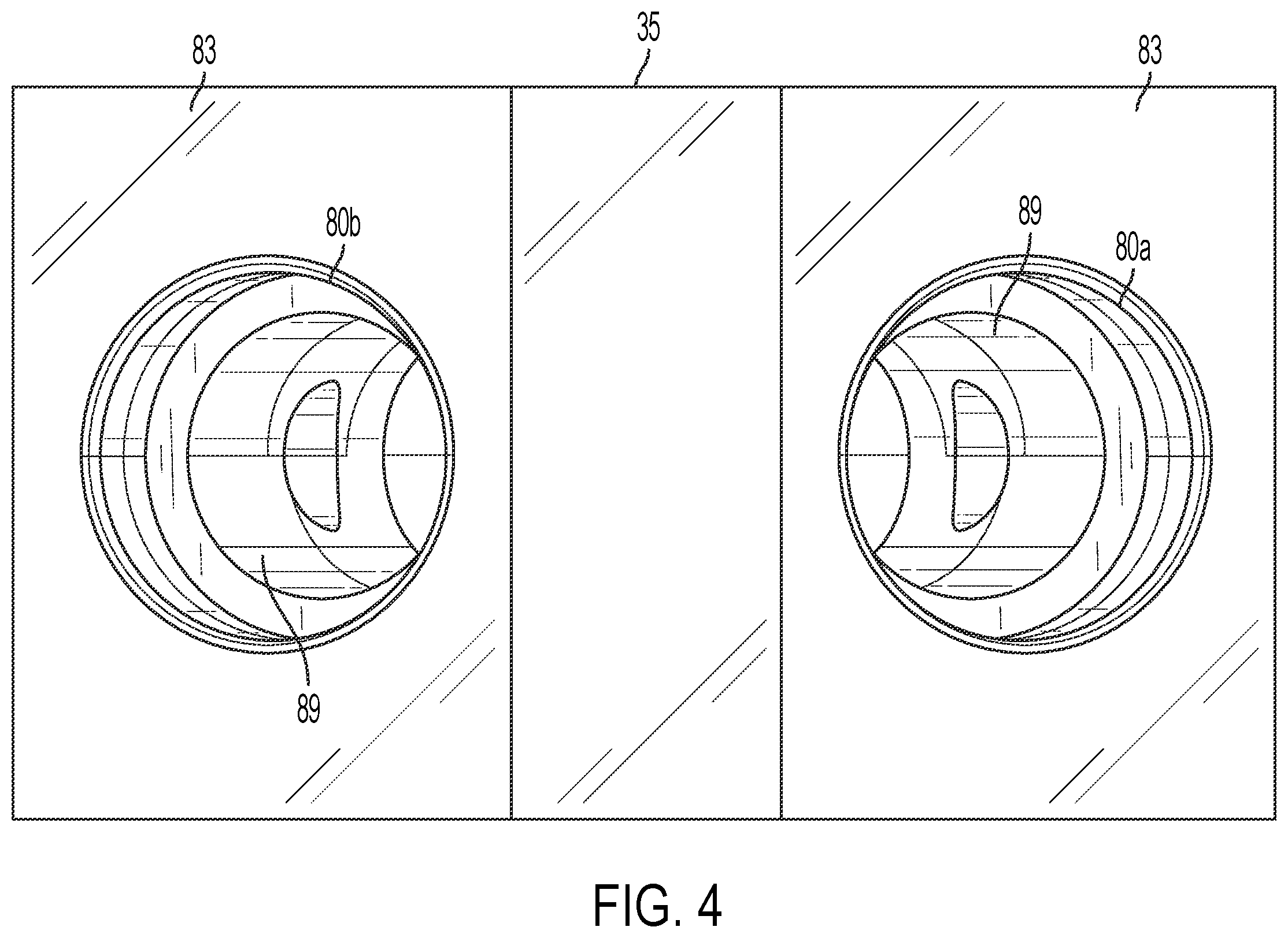 Patent US12338586 Figure 4 – Method and apparatus for creating an overlay to reinforce and repair hard surfaces