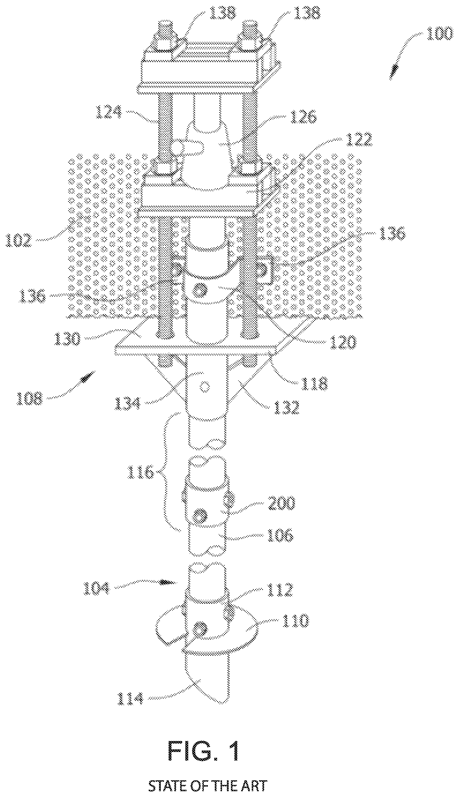 Patent US12338598 Figure 1 – Modular helical pier foundation support systems, assemblies and methods with snap-lock couplings