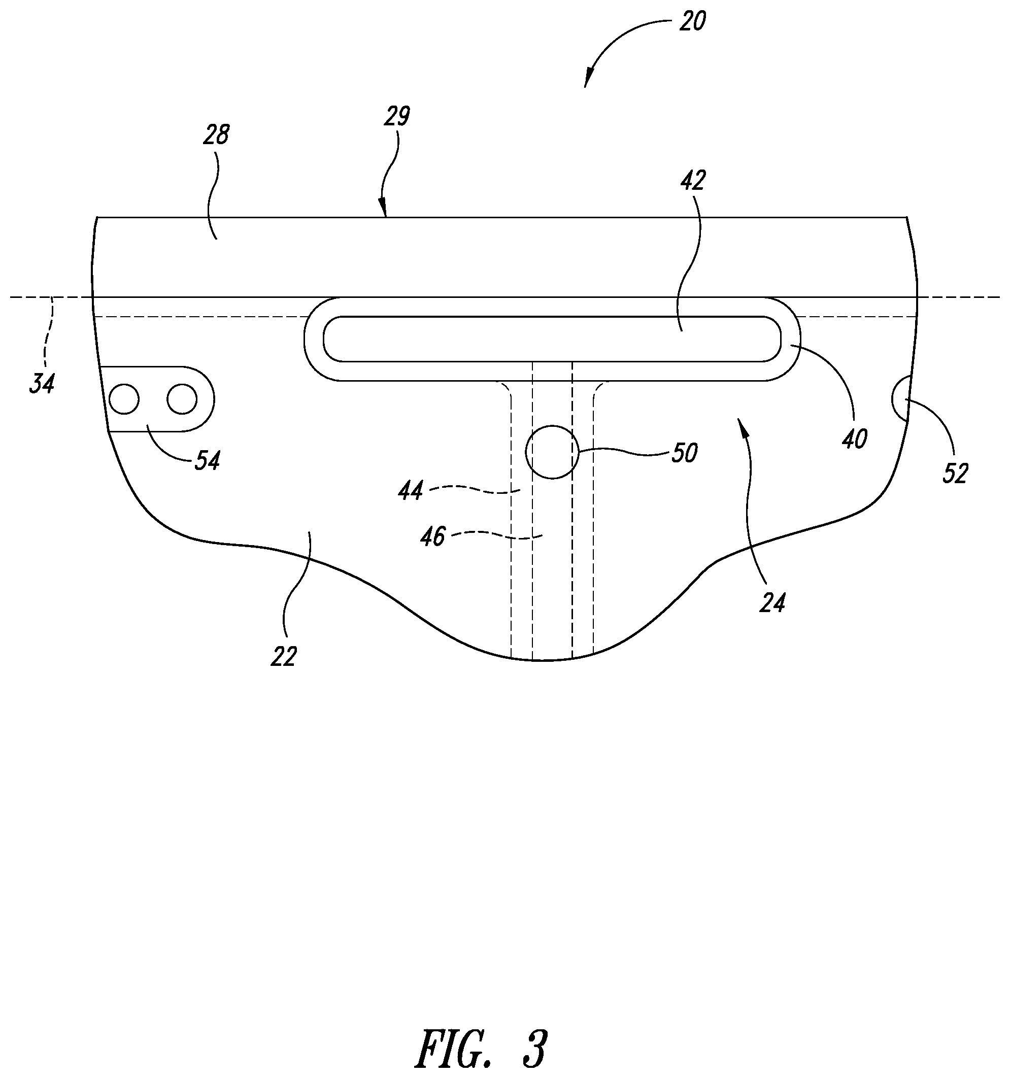 Patent US12338611 Figure 3 – Undermount sink