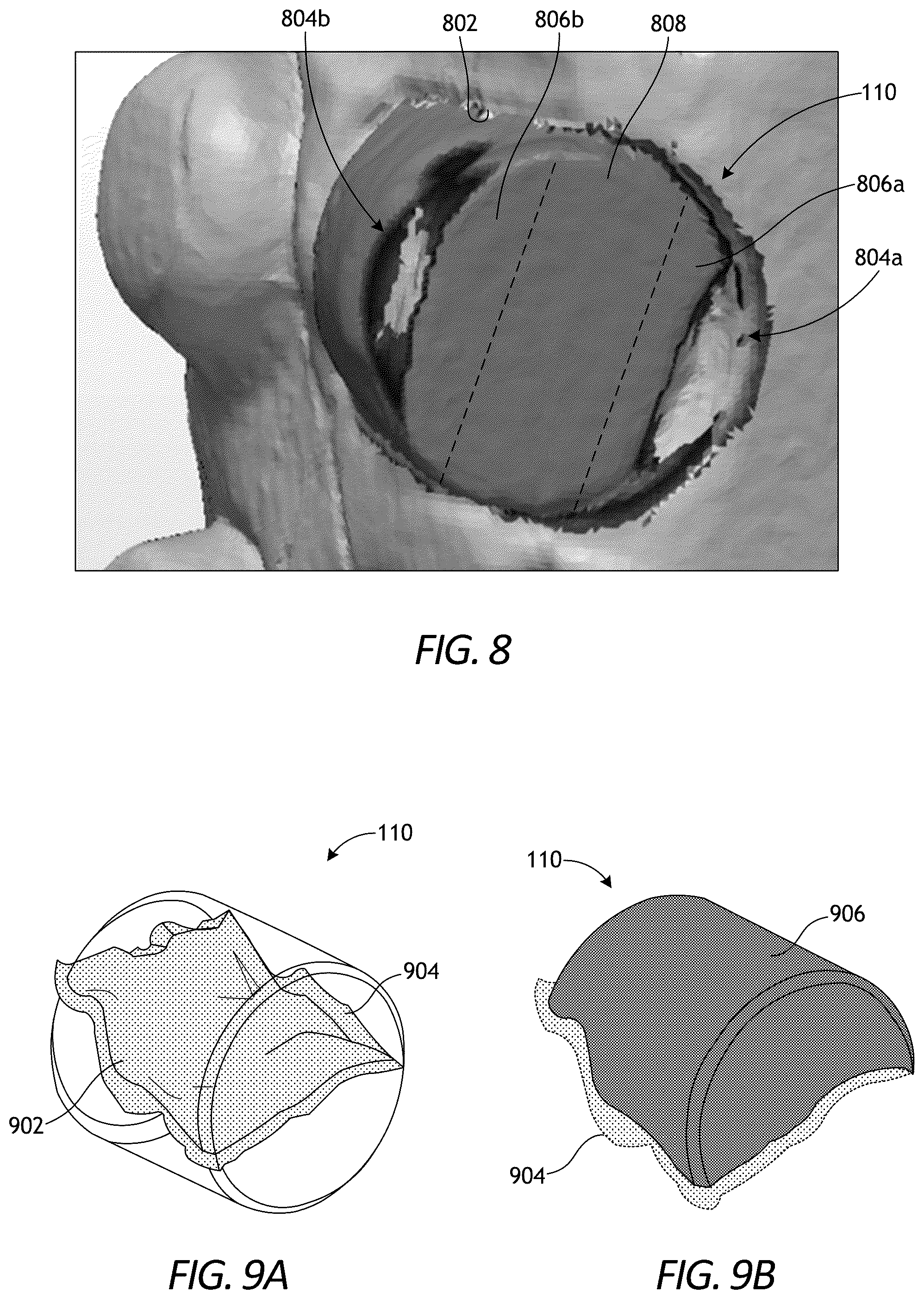 Patent US12338686 Figure 11 – Wear data quantification for well tools