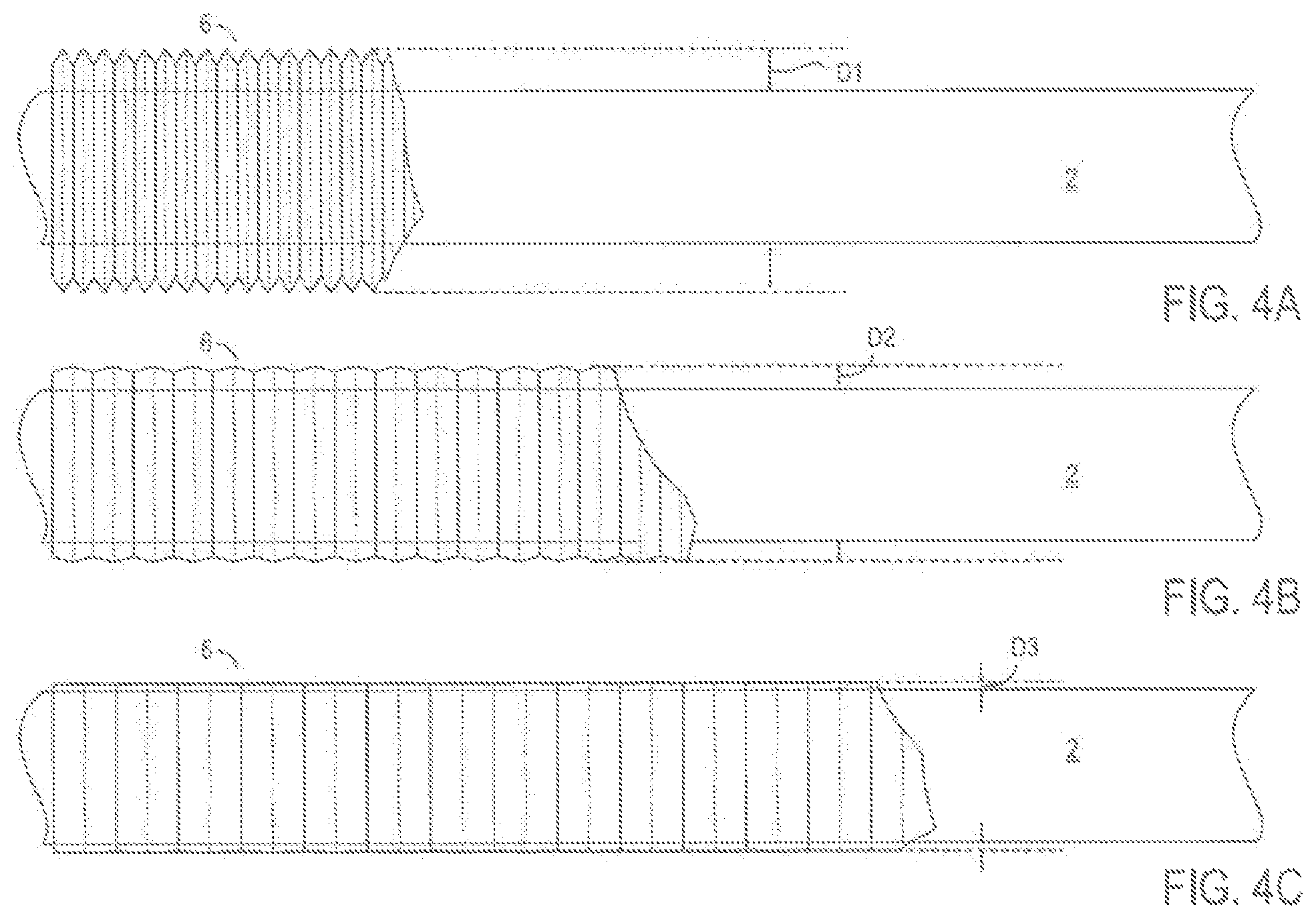 Patent US12338712 Figure 4 – Systems and methods for thermal management of subsea conduits using a jumper having adjustable insulating elements
