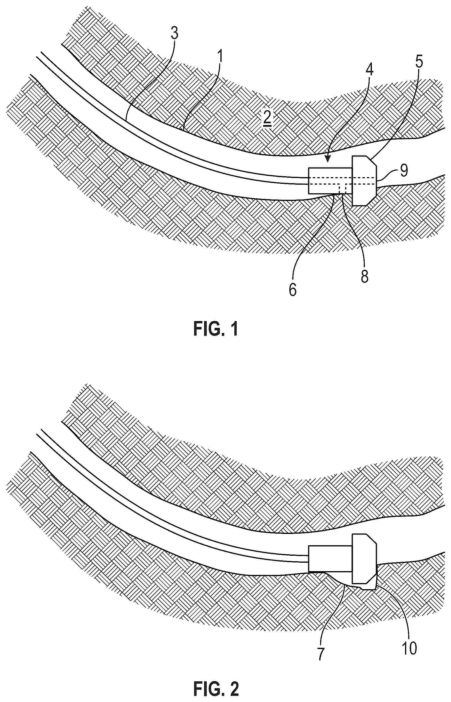 Patent US12338735 Figure 1 – Method and apparatus for creation of an open hole sidetrack