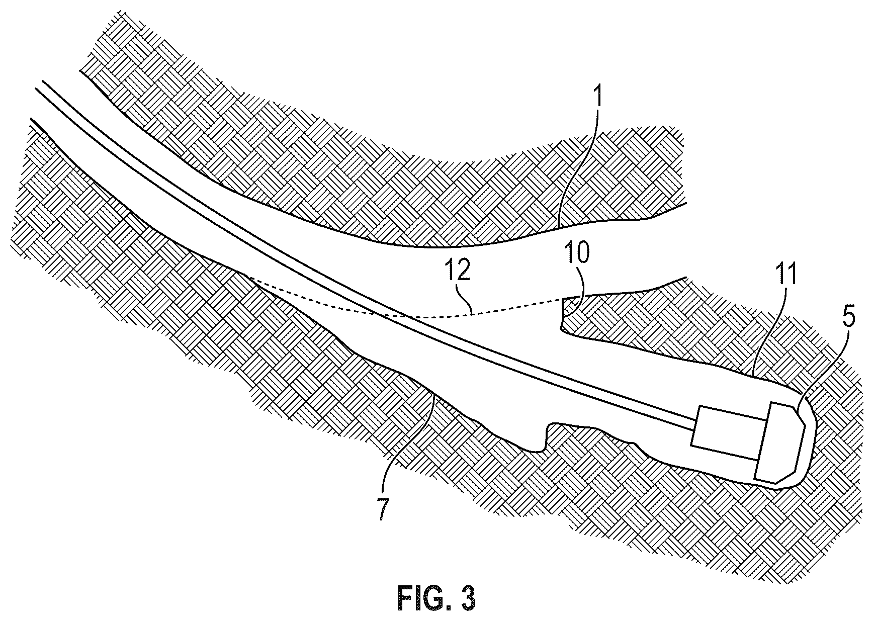 Patent US12338735 Figure 2 – Method and apparatus for creation of an open hole sidetrack
