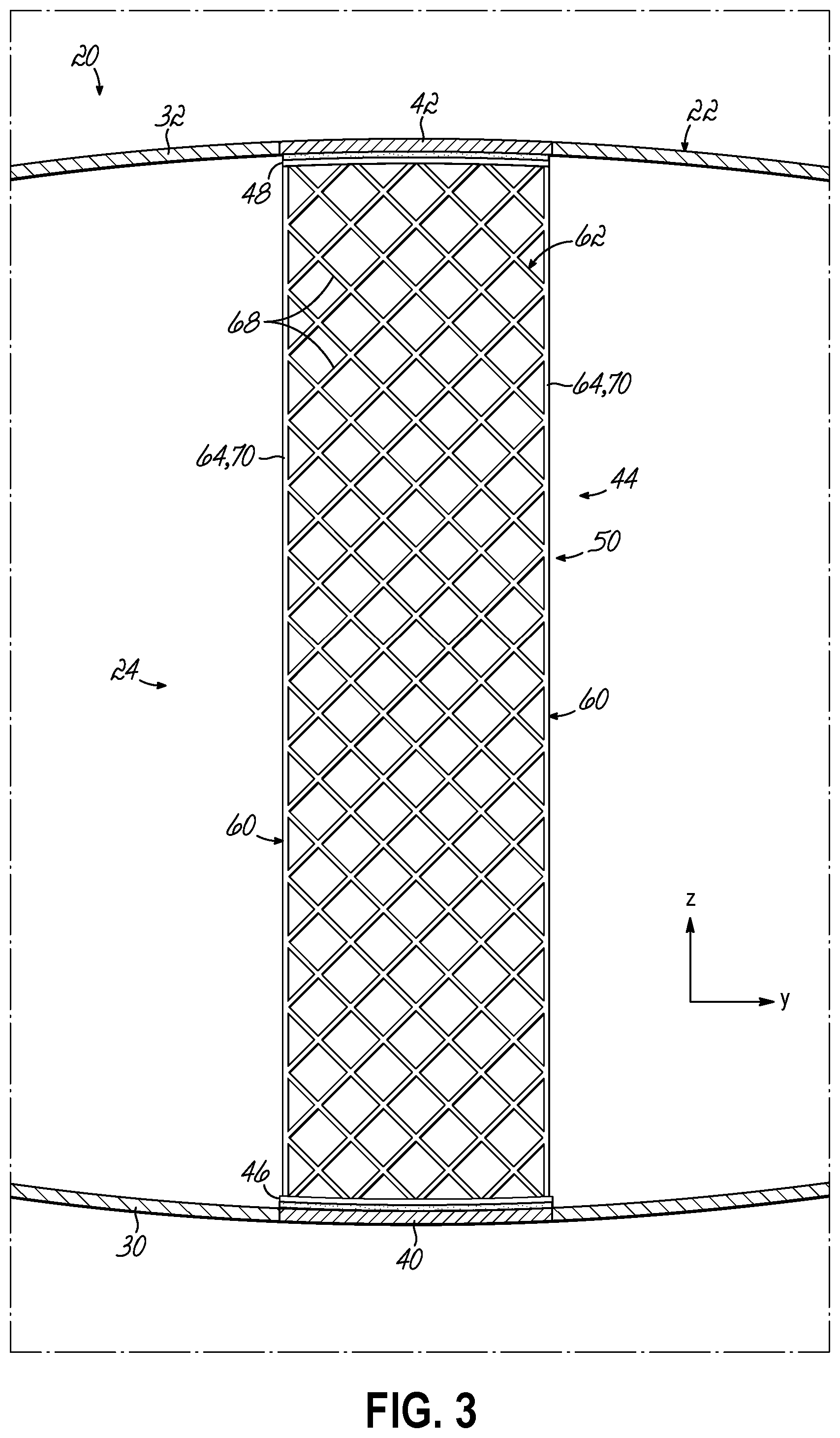 Patent US12338787 Figure 3 – Shear web for a wind turbine blade and method of making same