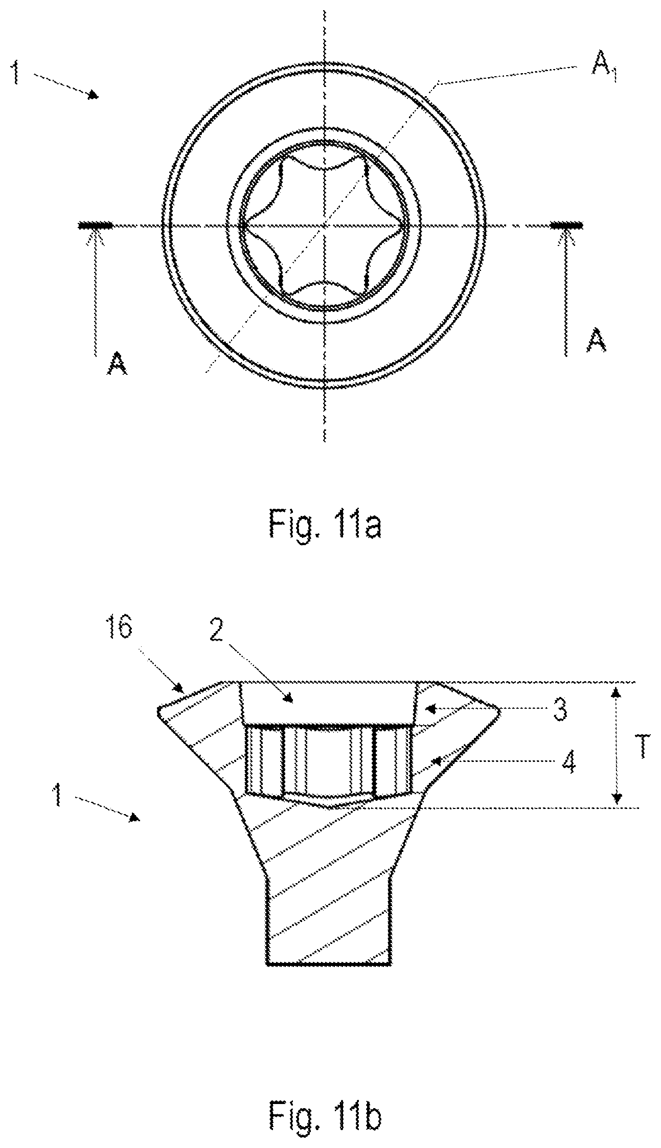 Patent US12338849 Figure 11 – Screw drive