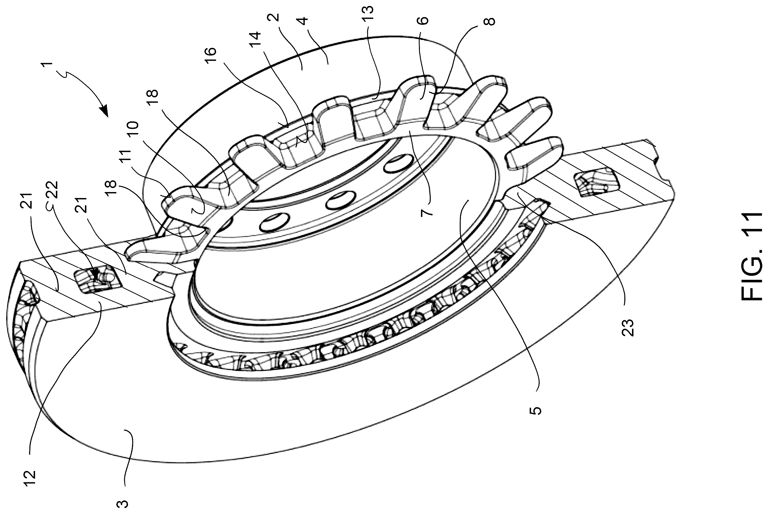 Patent US12338867 Figure 6 – Disk brake disk, disk brake and manufacturing method