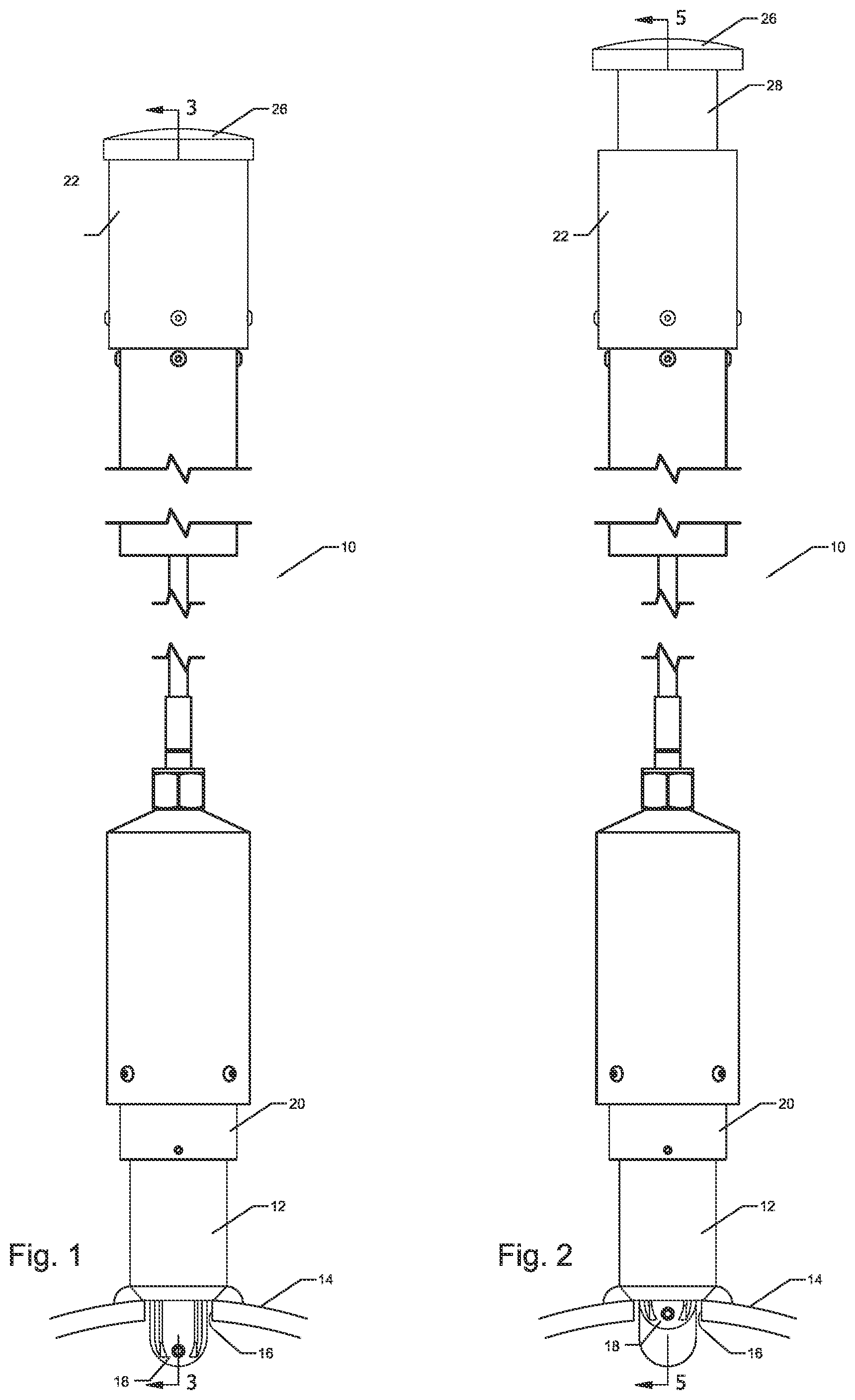 Patent US12338940 Figure 1 – Pig detector