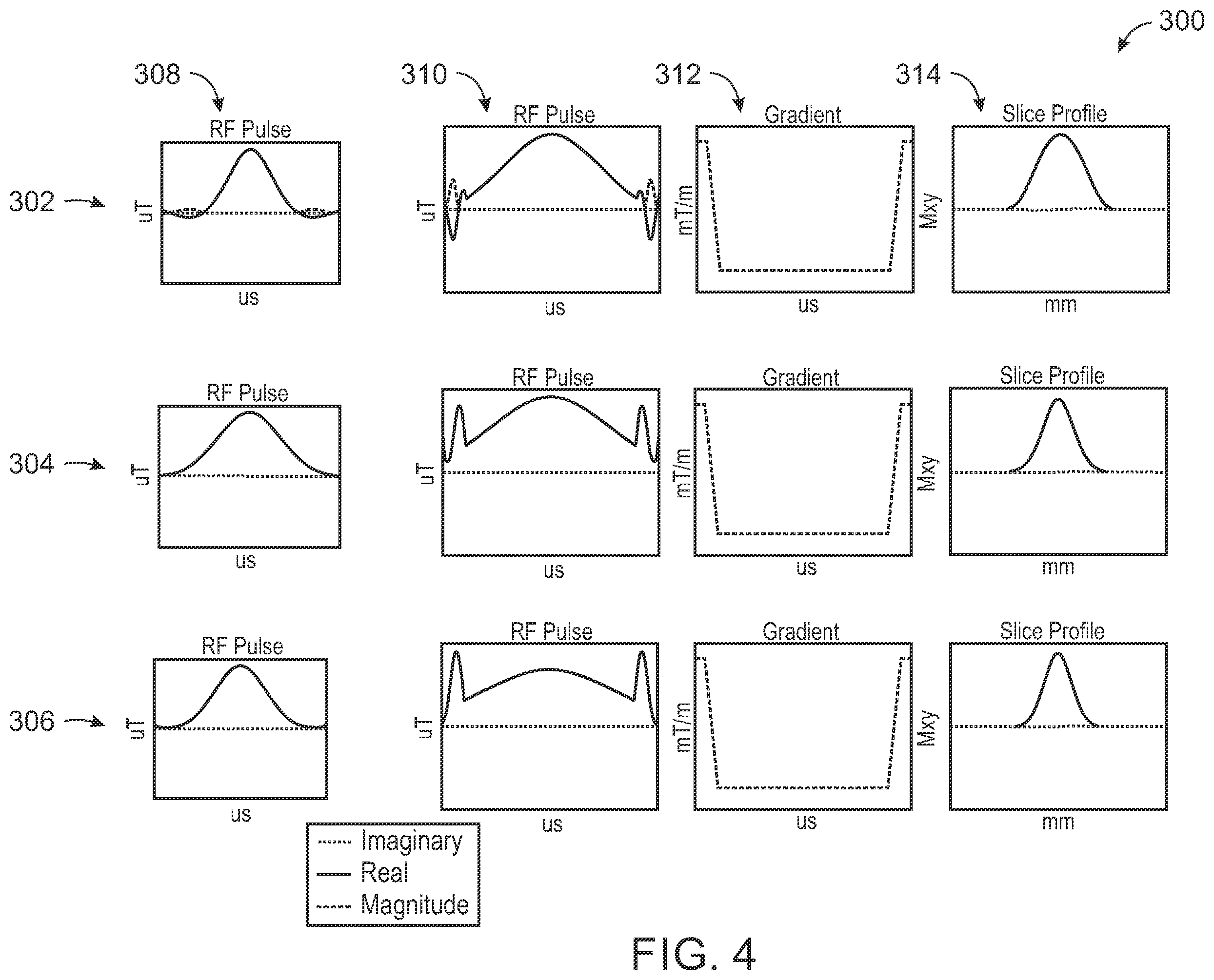 Patent US12339336 Figure 4 – System and method to reduce specific absorption rate in magnetic resonance imaging