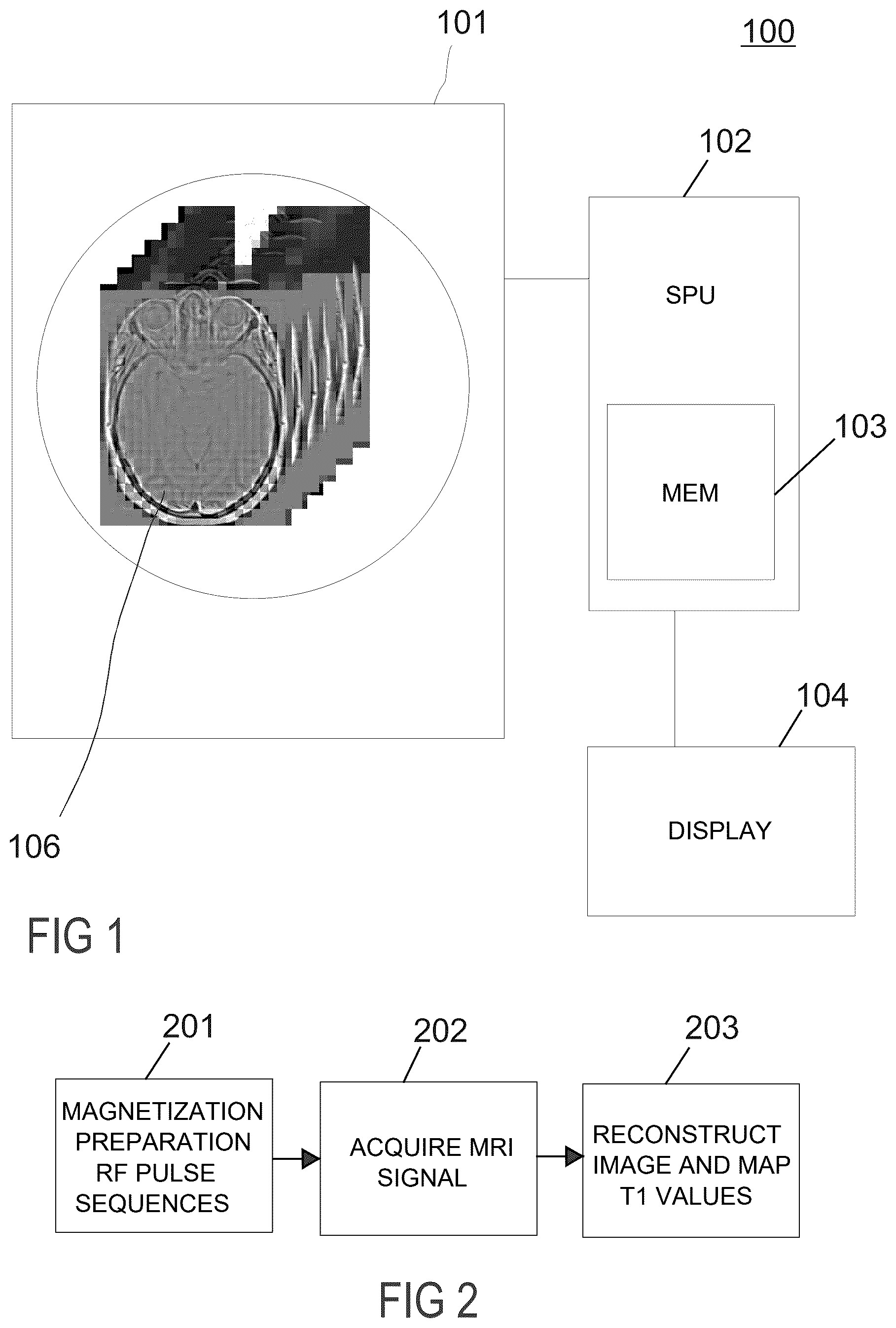 Patent US12339339 Figure 1 – Method and system for T1 mapping for tissue characterized by short-T2 relaxation in MRI
