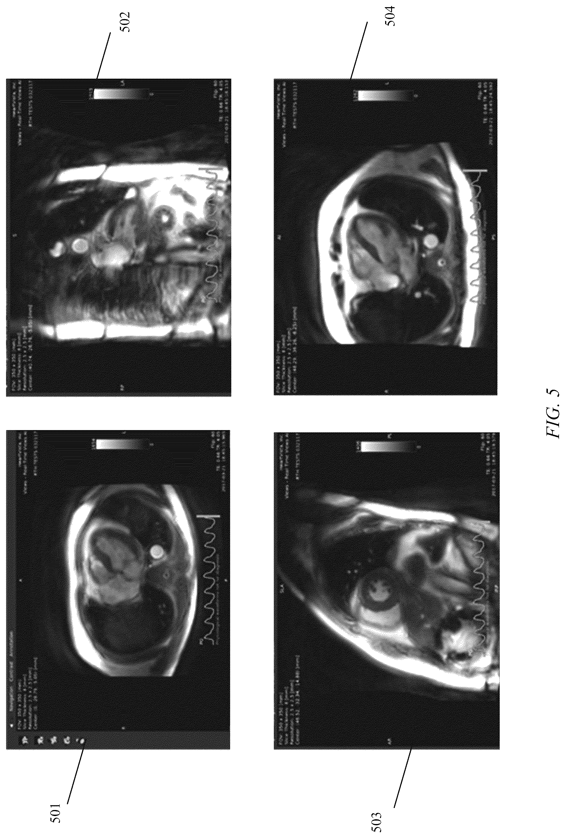 Patent US12339340 Figure 6 – Imaging device parameter control for image capture and replacement