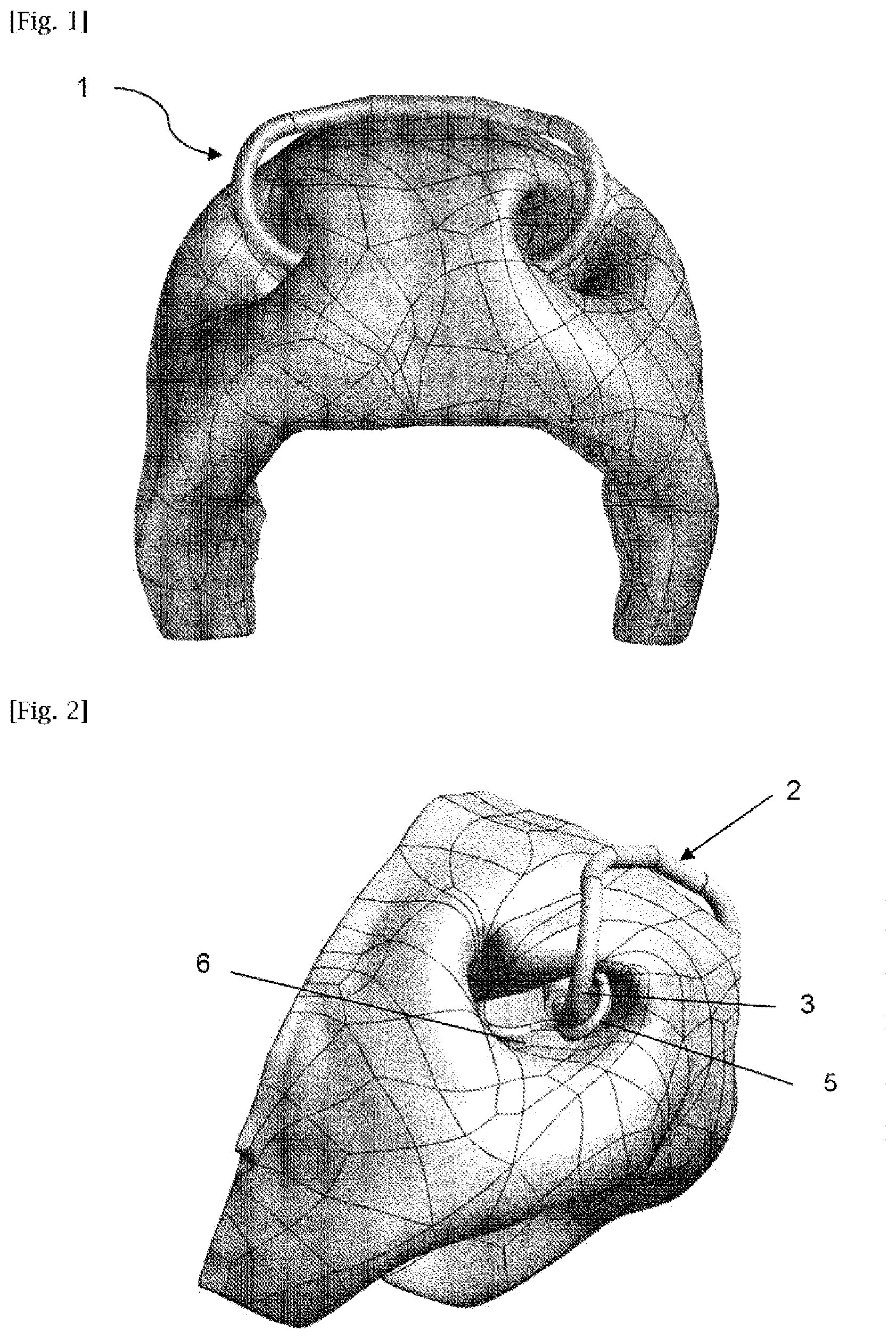 Patent US12342792 — Nose ring for ruminants — Figure 1
