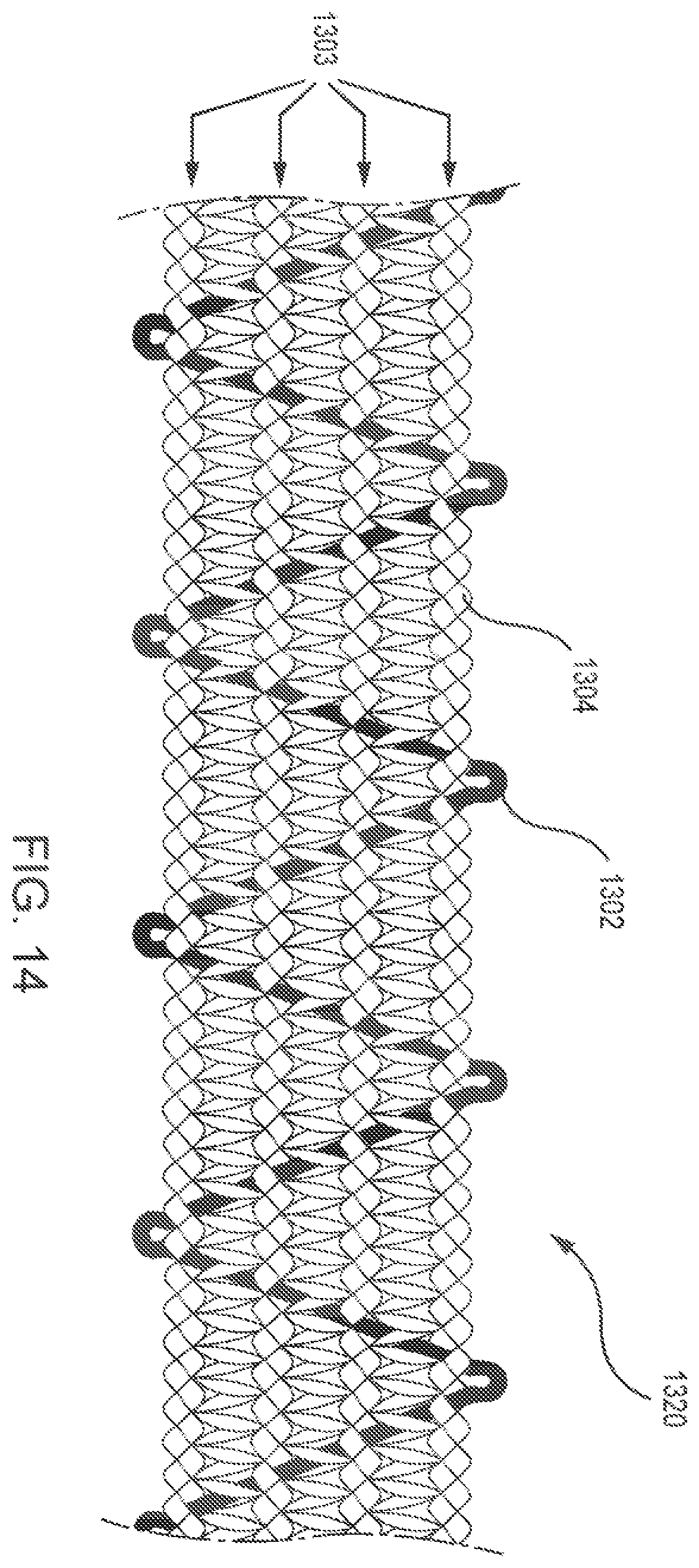 Patent US12342877 Figure 20 – Conductive band for biosensing garments