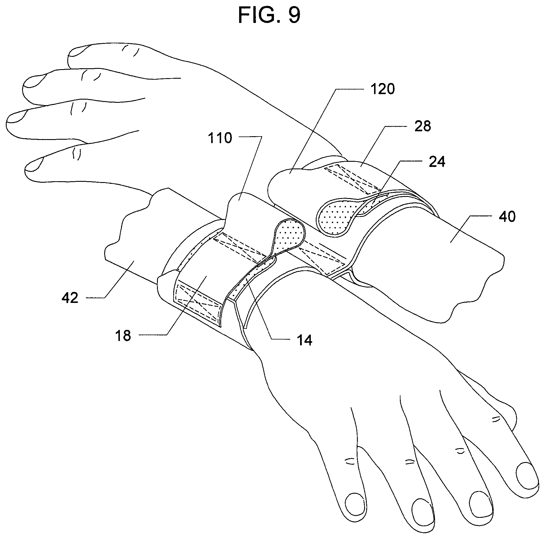 Patent US12342881 Figure 4 – Disposable wrist securing device with escape feature system and method