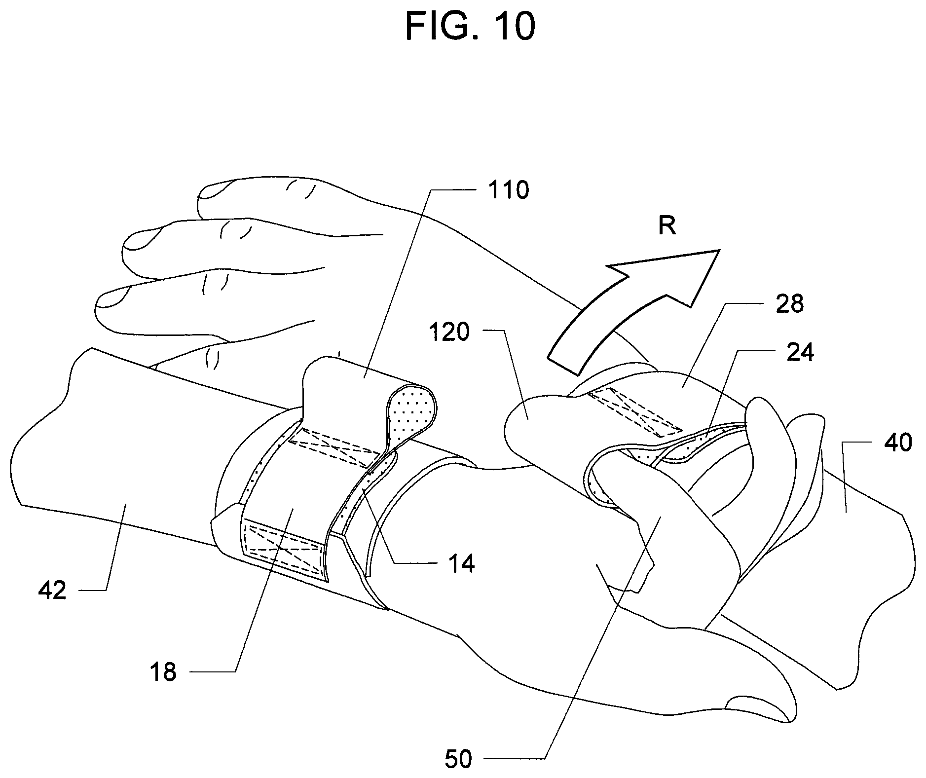 Patent US12342881 Figure 5 – Disposable wrist securing device with escape feature system and method