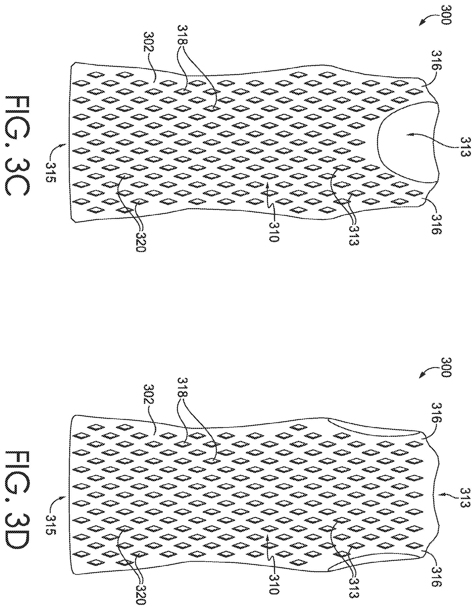 Patent US12342884 Figure 4 – Apparel with cling reduction features