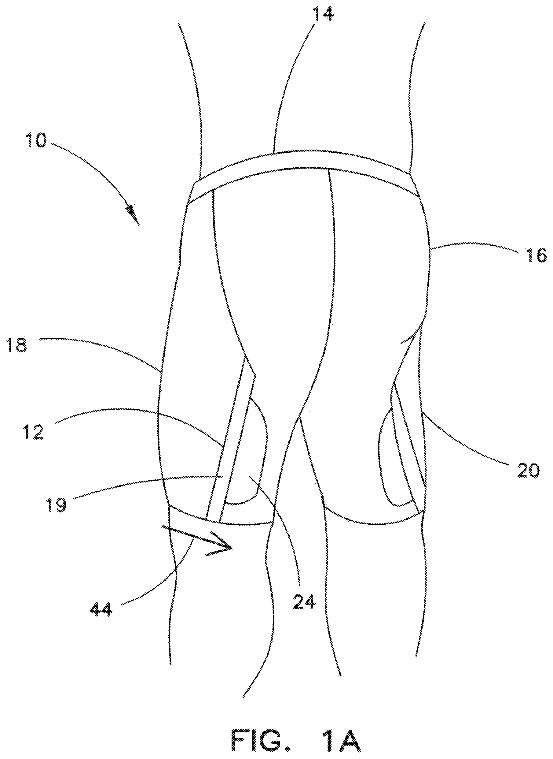 Patent US12342888 — Garment with compression adjustment arrangement — Figure 1