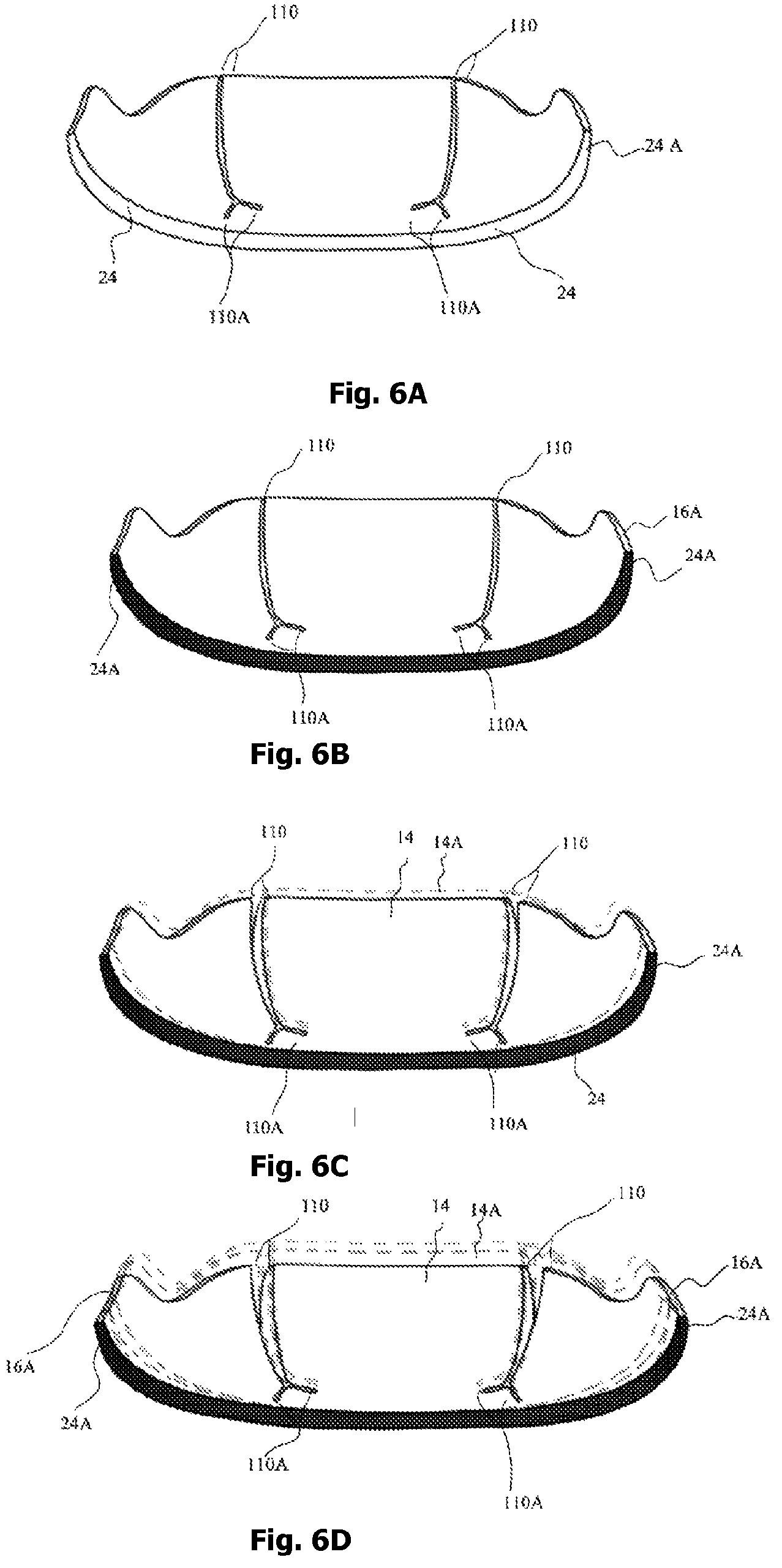 Patent US12342905 Figure 9 – Expandable shoe capable to grow with a wearer/user's feet for more than three sizes