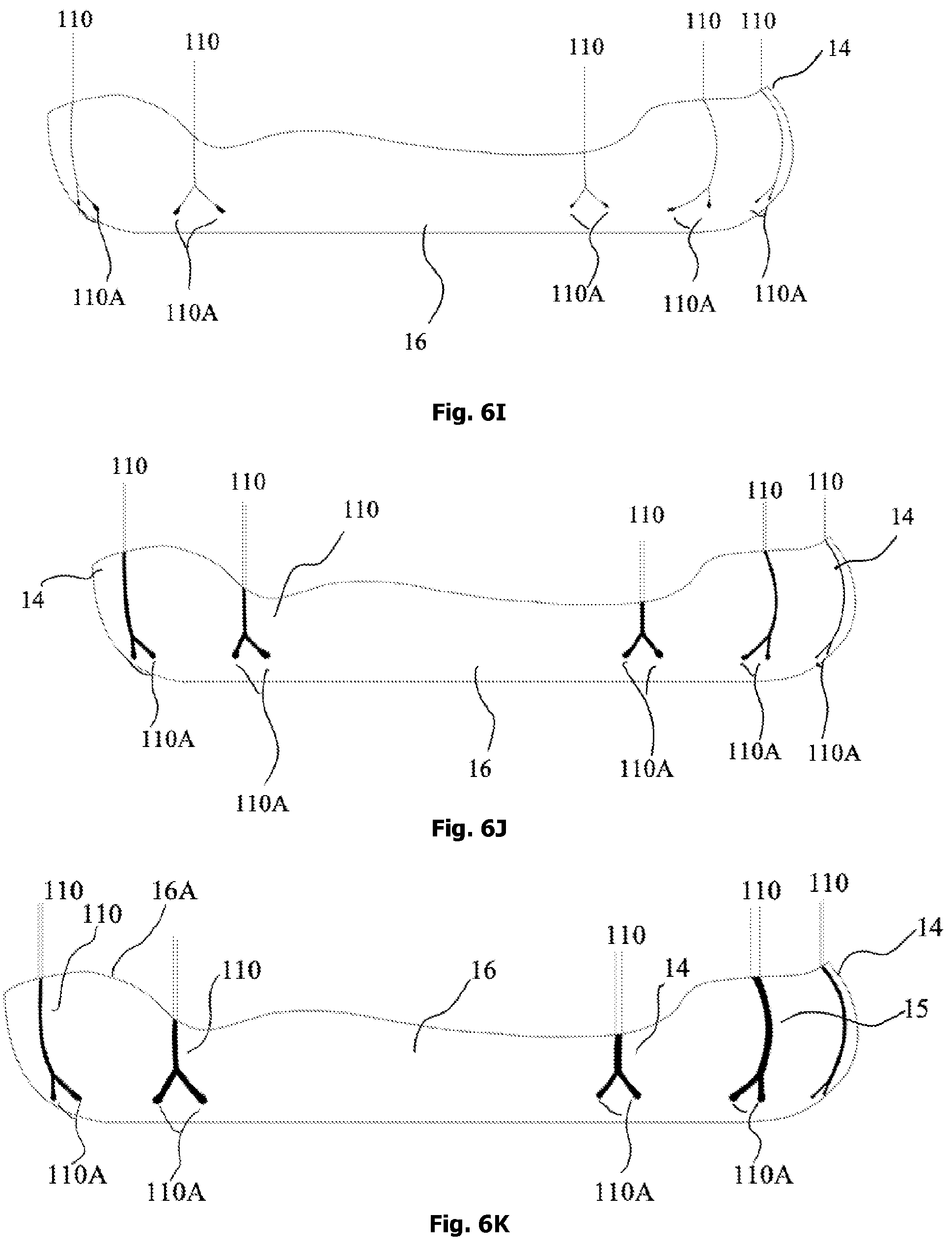 Patent US12342905 Figure 11 – Expandable shoe capable to grow with a wearer/user's feet for more than three sizes